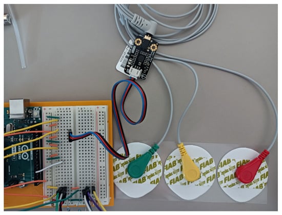 Sensors 23 03036 g005