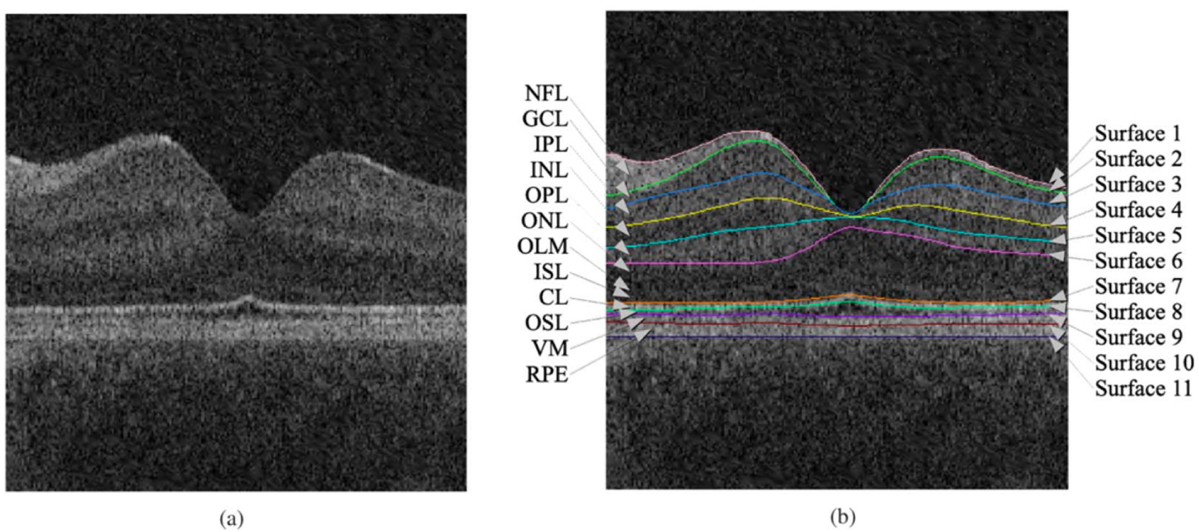 Sensors 23 03144 g003
