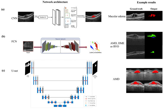 Sensors 23 03144 g005