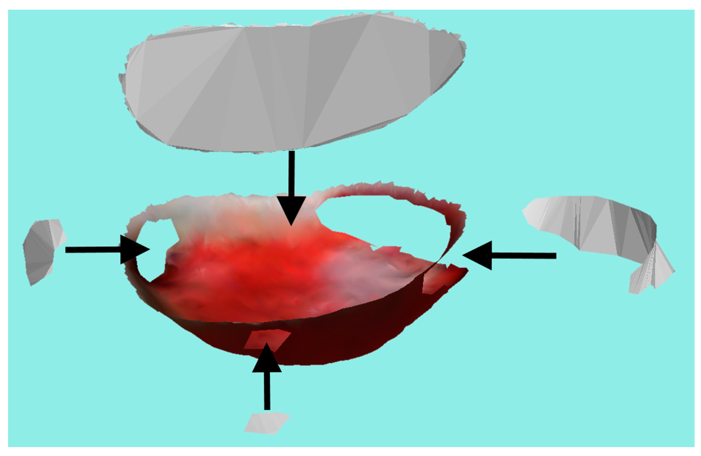 Sensors 23 03298 g015