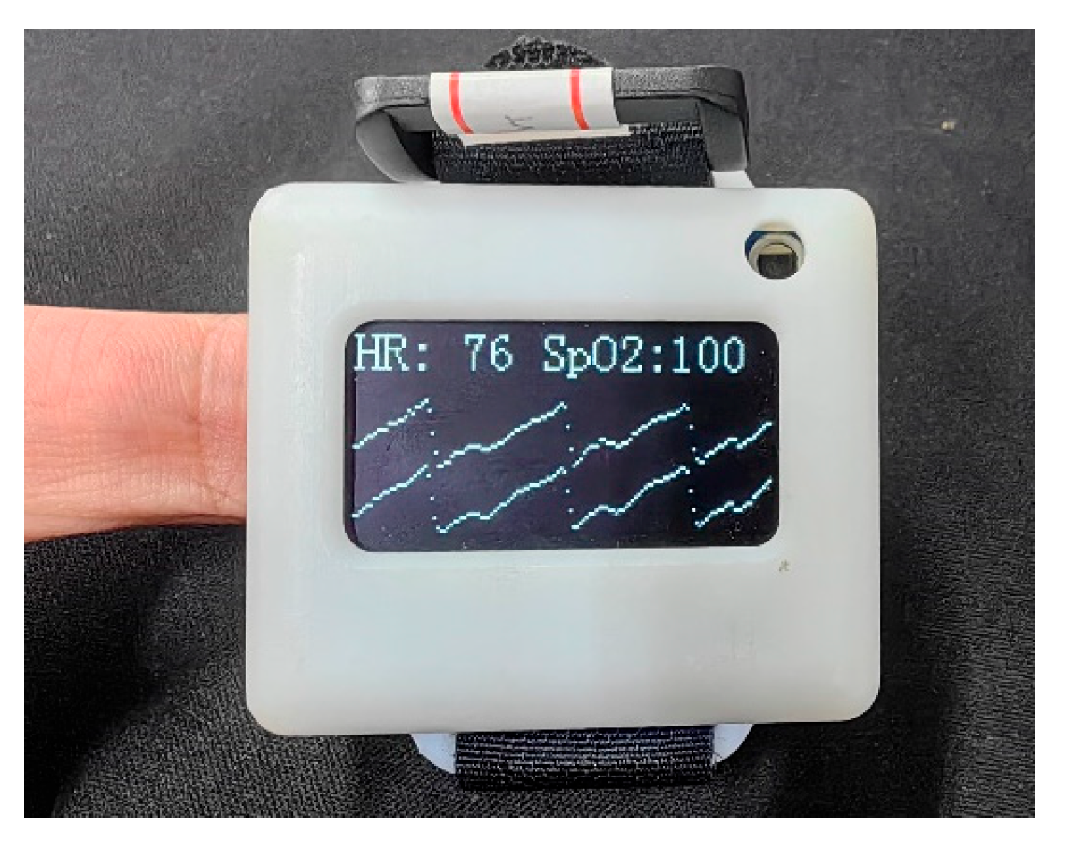 Sensors 23 03359 g002