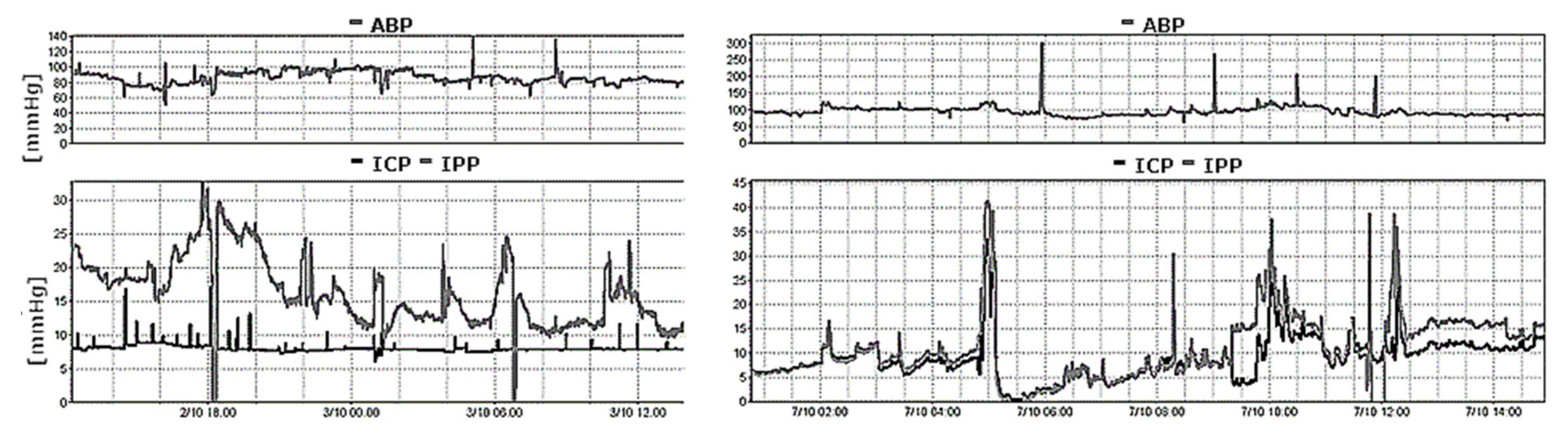Sensors 23 03397 g004 Sensors 23 03397 g004