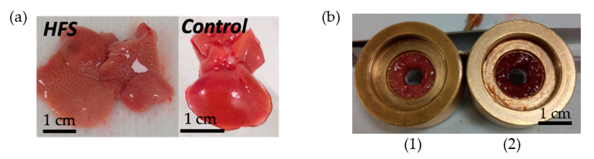 Sensors 23 03434 g004