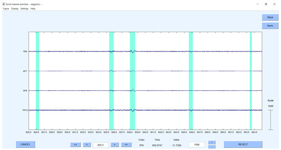 Sensors 23 03474 g0a1