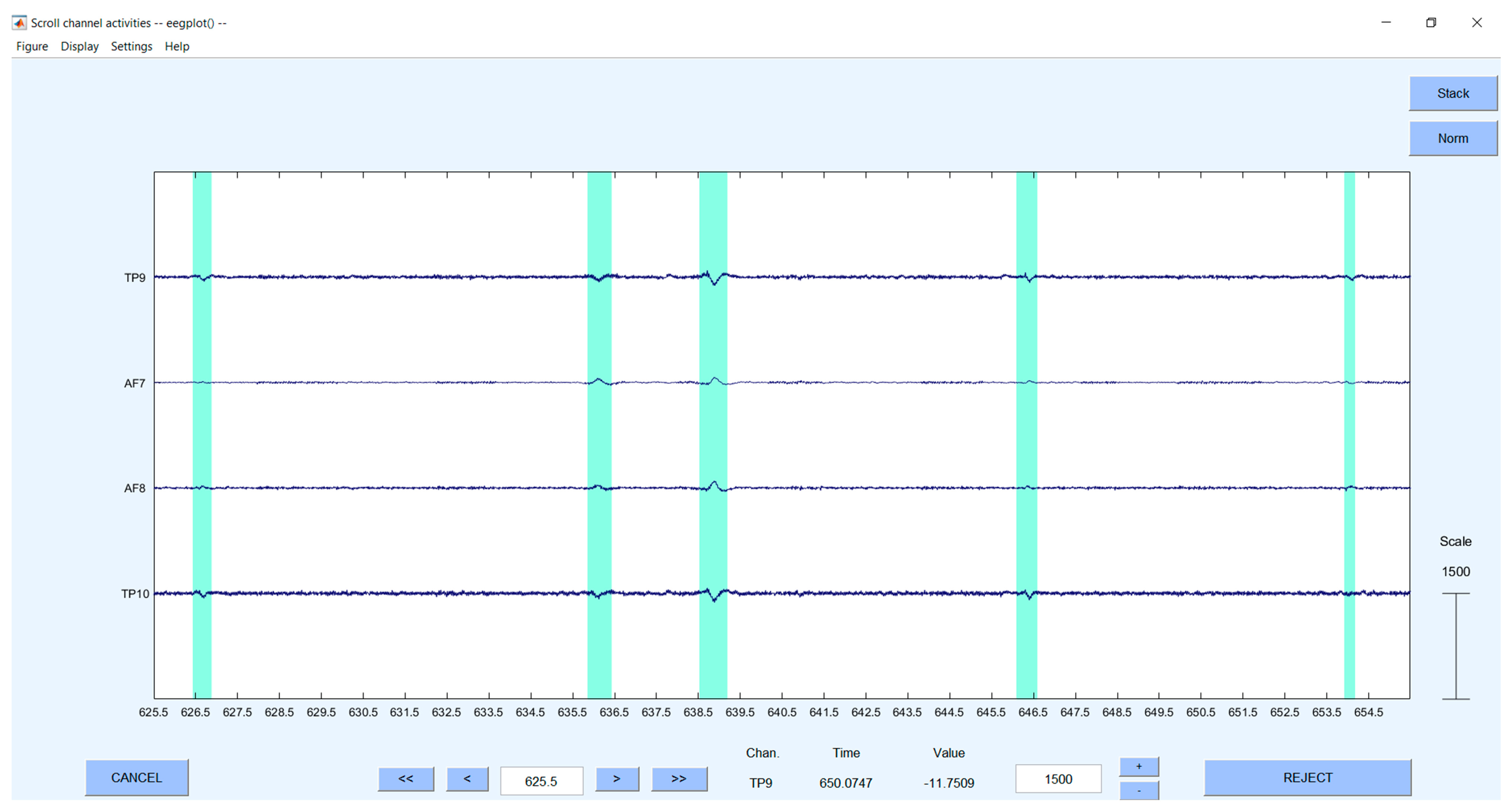 Sensors 23 03474 g0a1