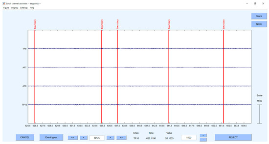 Sensors 23 03474 g0a2
