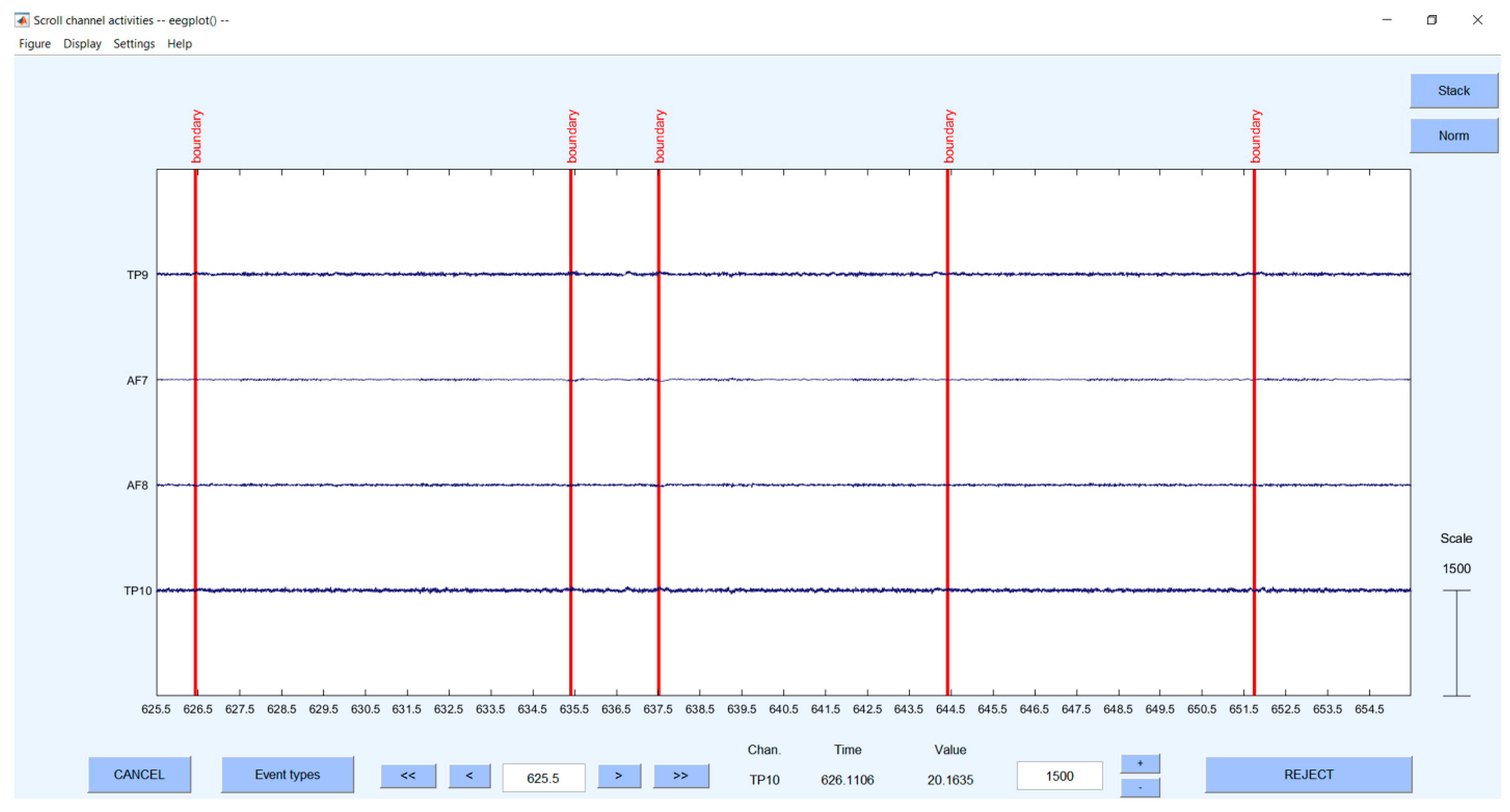 Sensors 23 03474 g0a2