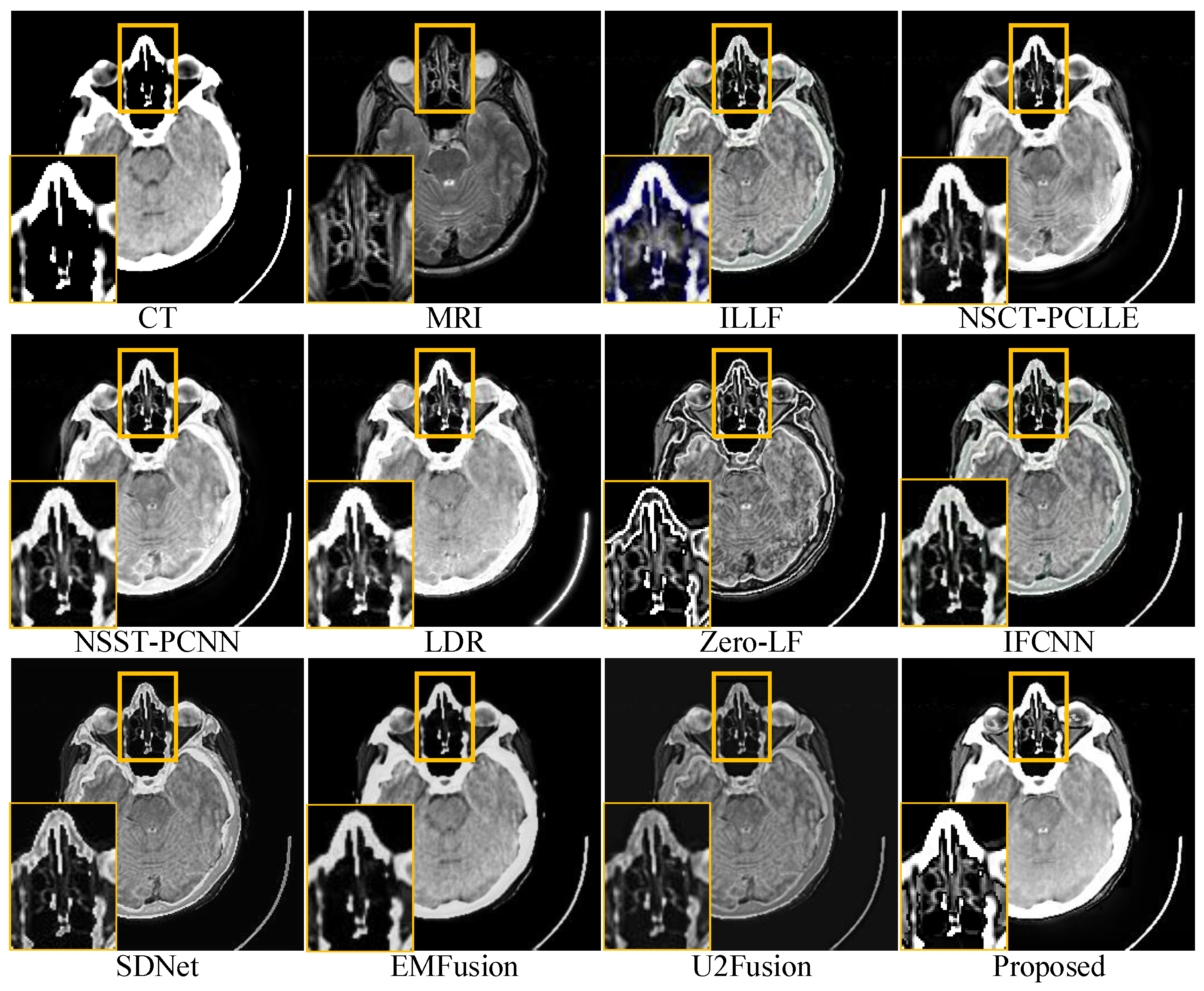 Sensors 23 03490 g005 Sensors 23 03490 g005