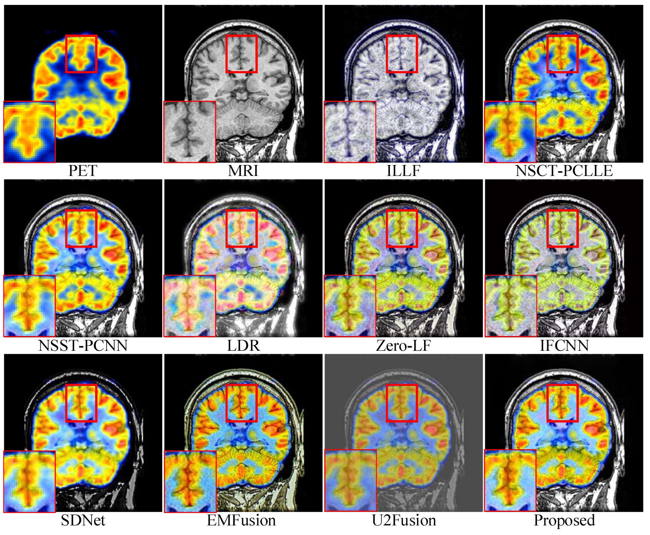 Sensors 23 03490 g006 Sensors 23 03490 g006