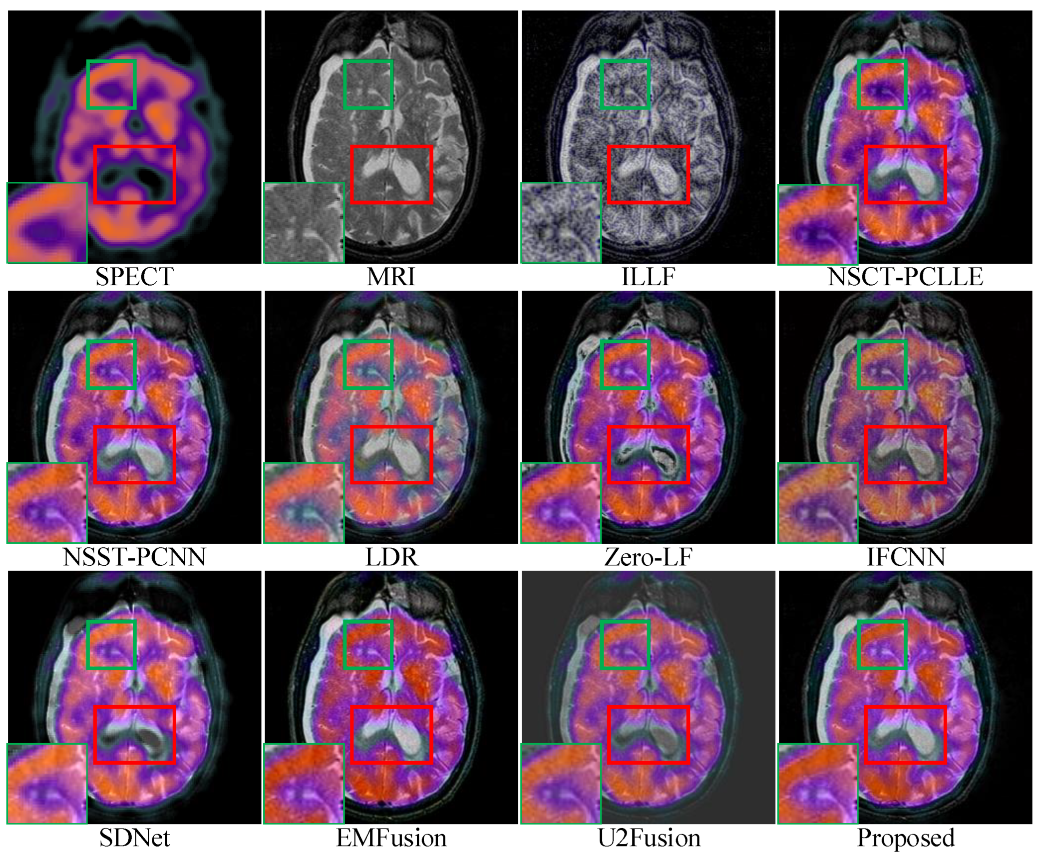 Sensors 23 03490 g007 Sensors 23 03490 g007