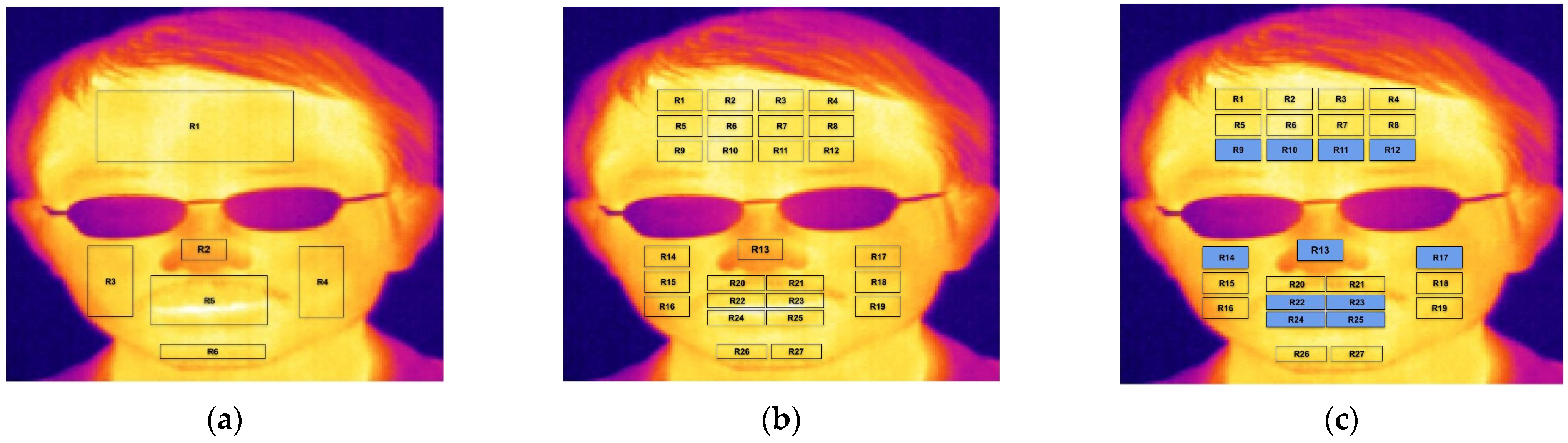 Sensors 23 03513 g003 Sensors 23 03513 g003
