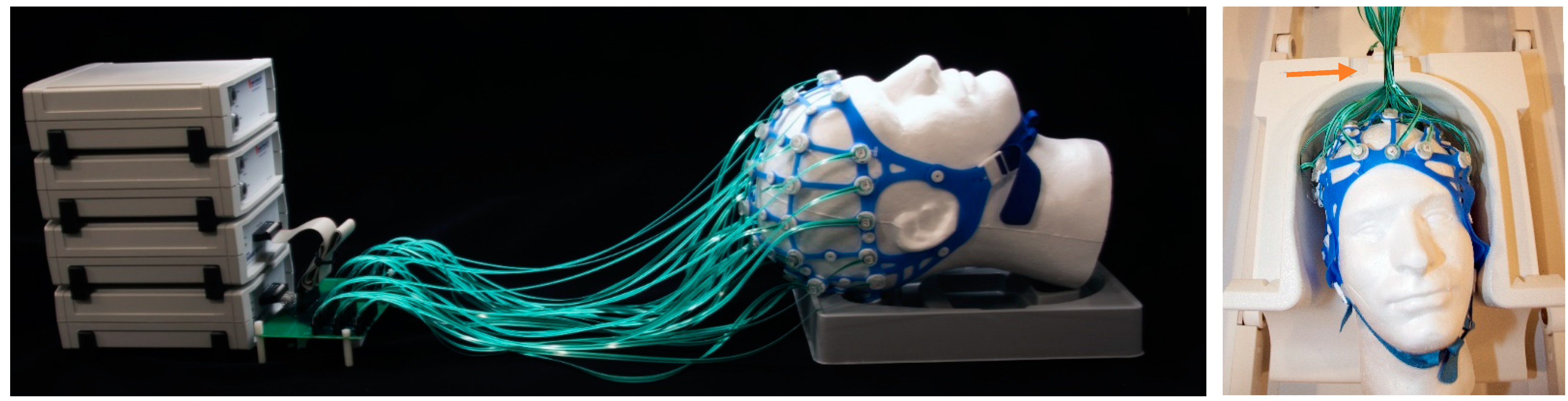 Sensors 23 03539 g002