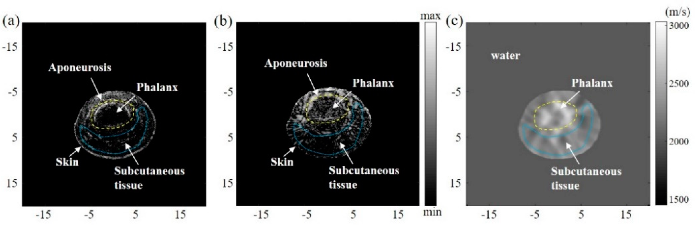 Sensors 23 03701 g006