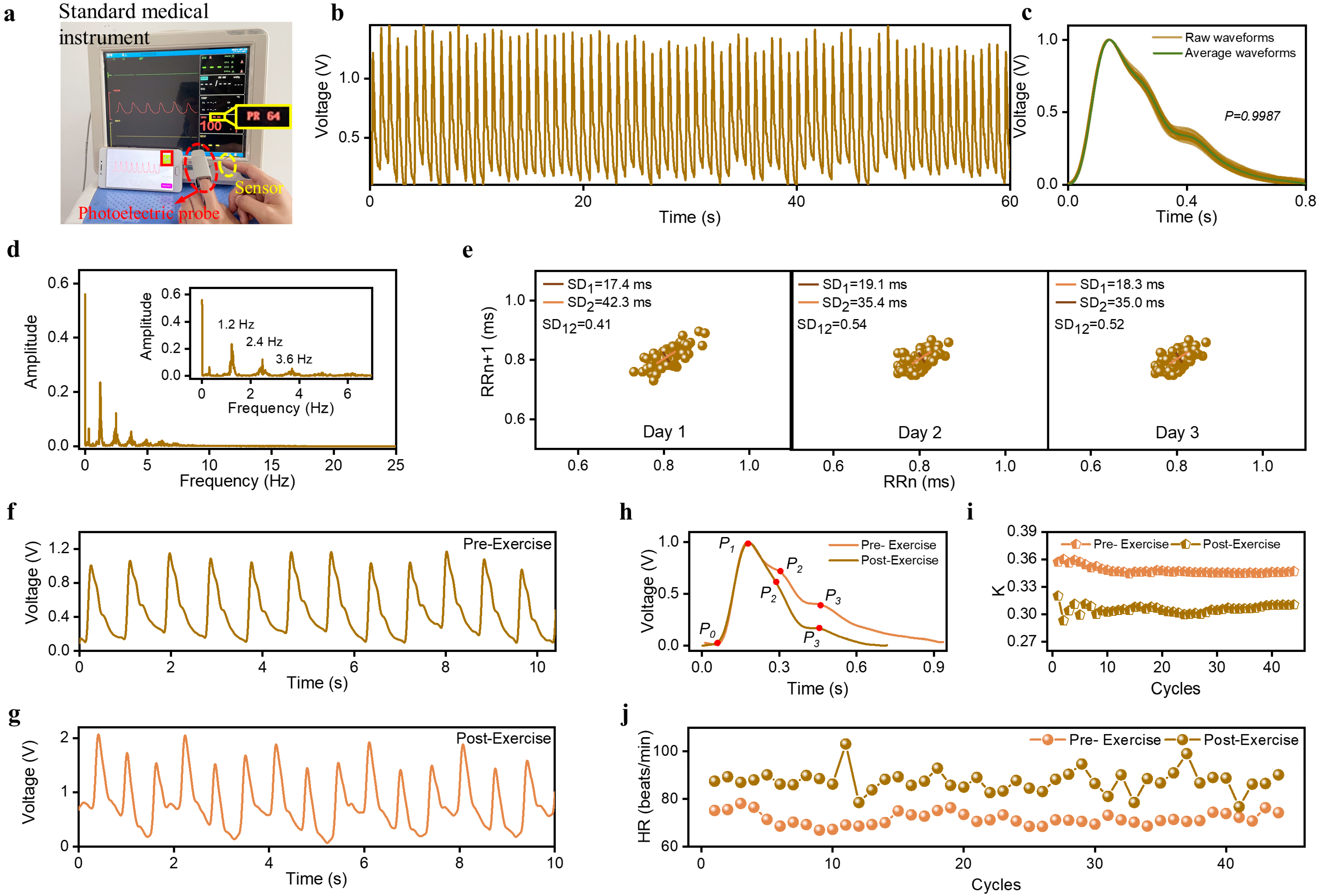 Sensors 23 03717 g004
