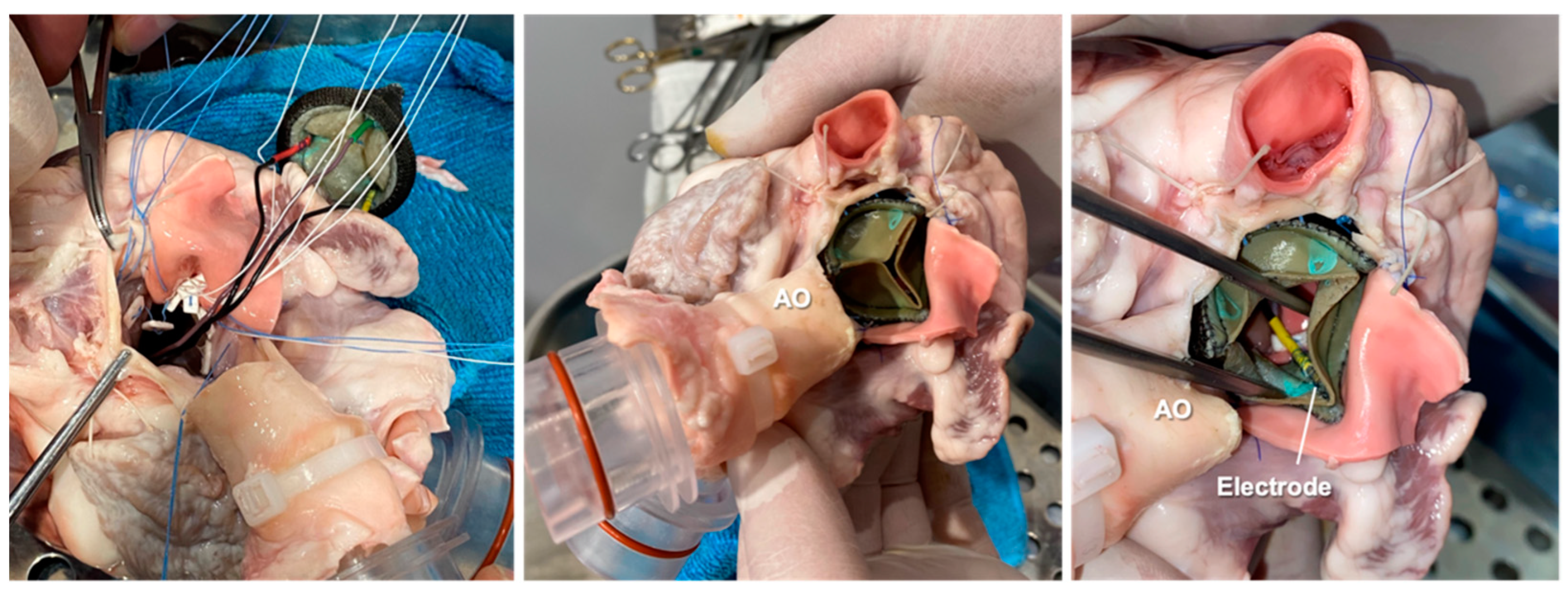 Sensors 23 03829 g003