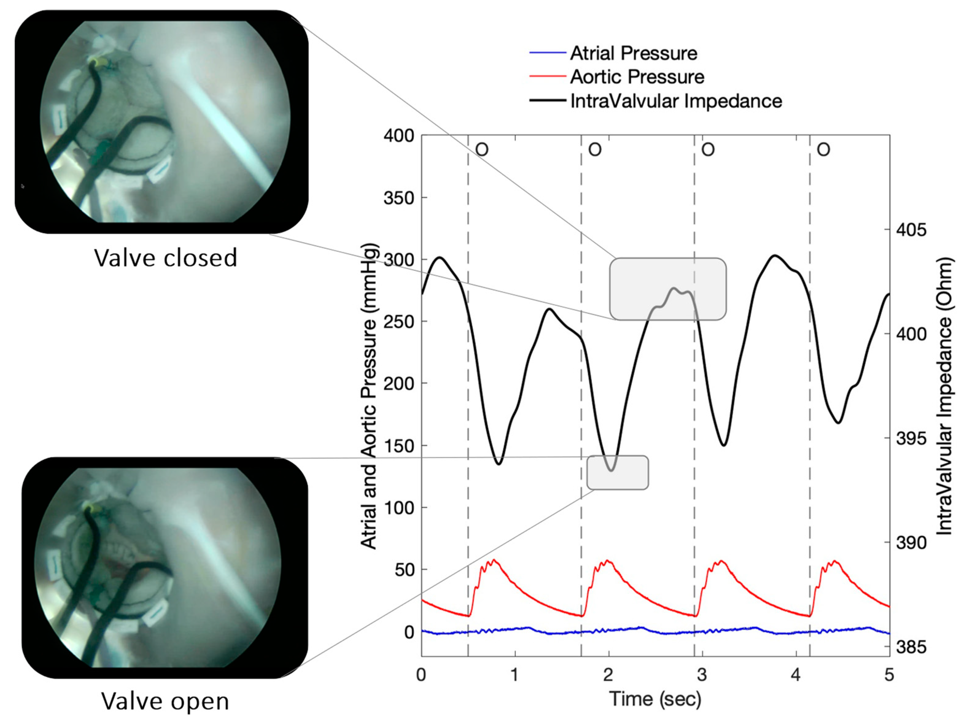Sensors 23 03829 g005