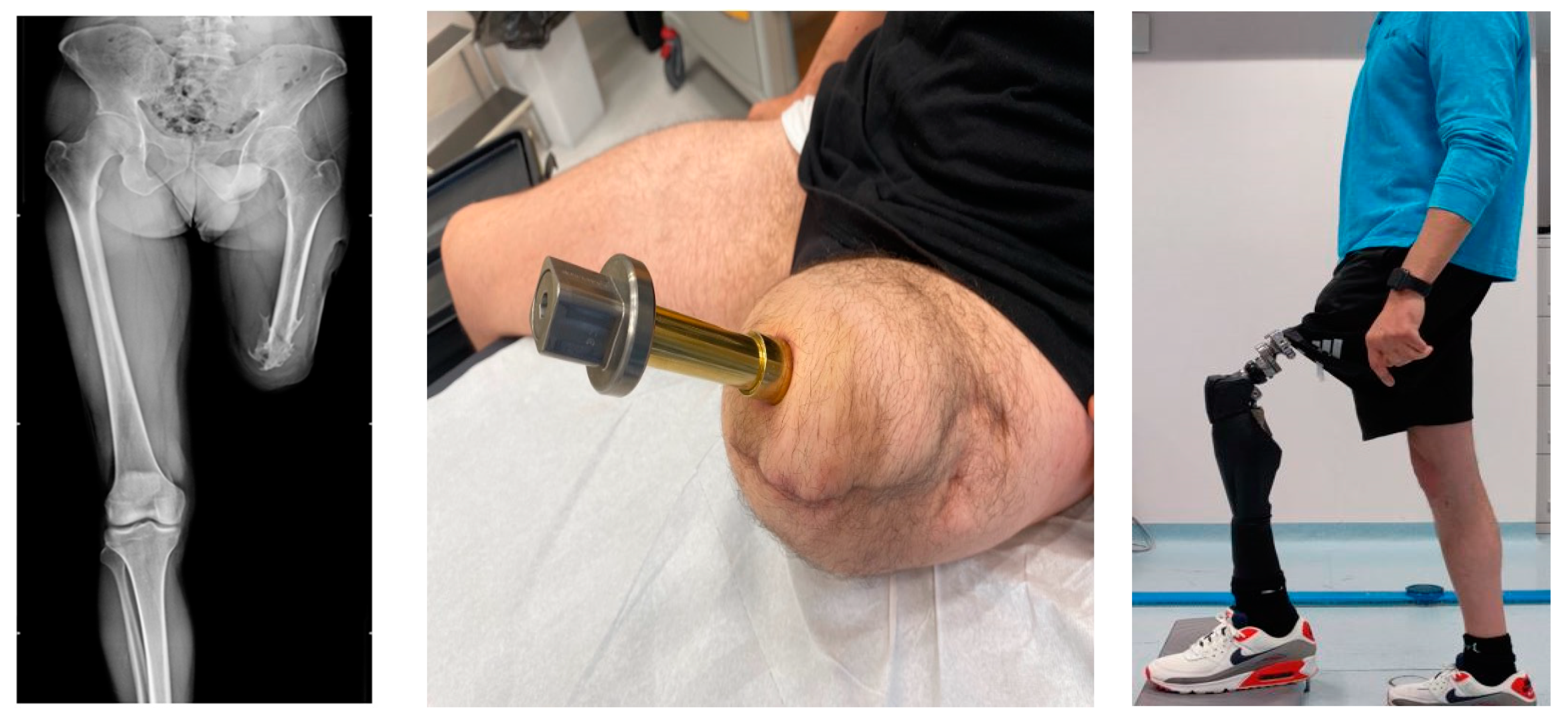 Sensors 23 04037 g002 Sensors 23 04037 g002