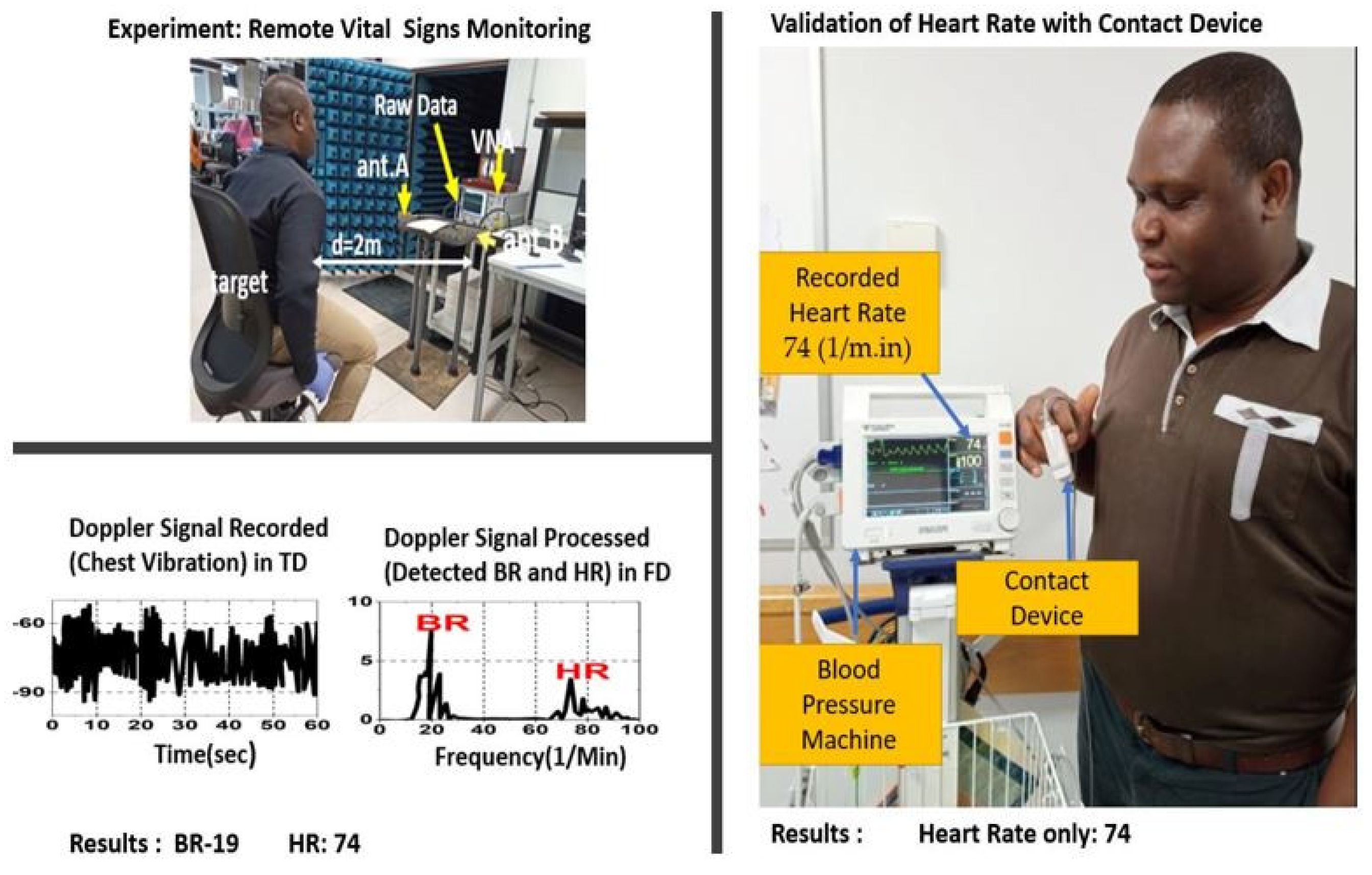 Sensors 23 04059 g015