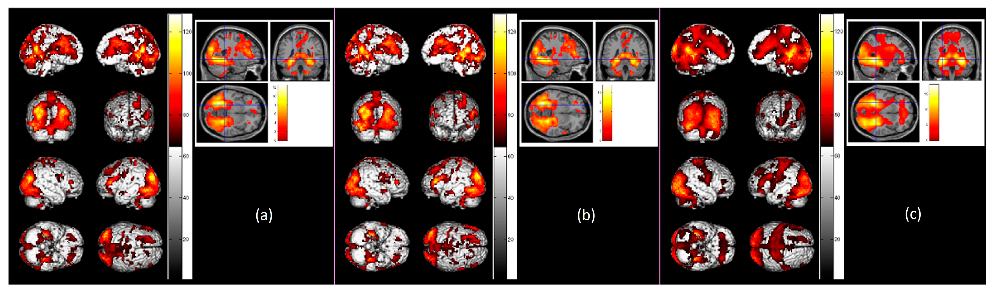 Sensors 23 04107 g005