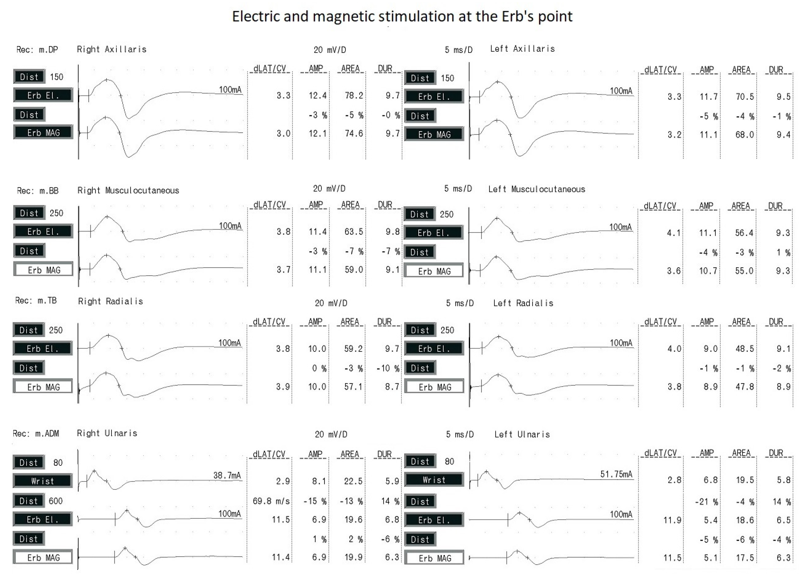 Sensors 23 04175 g004