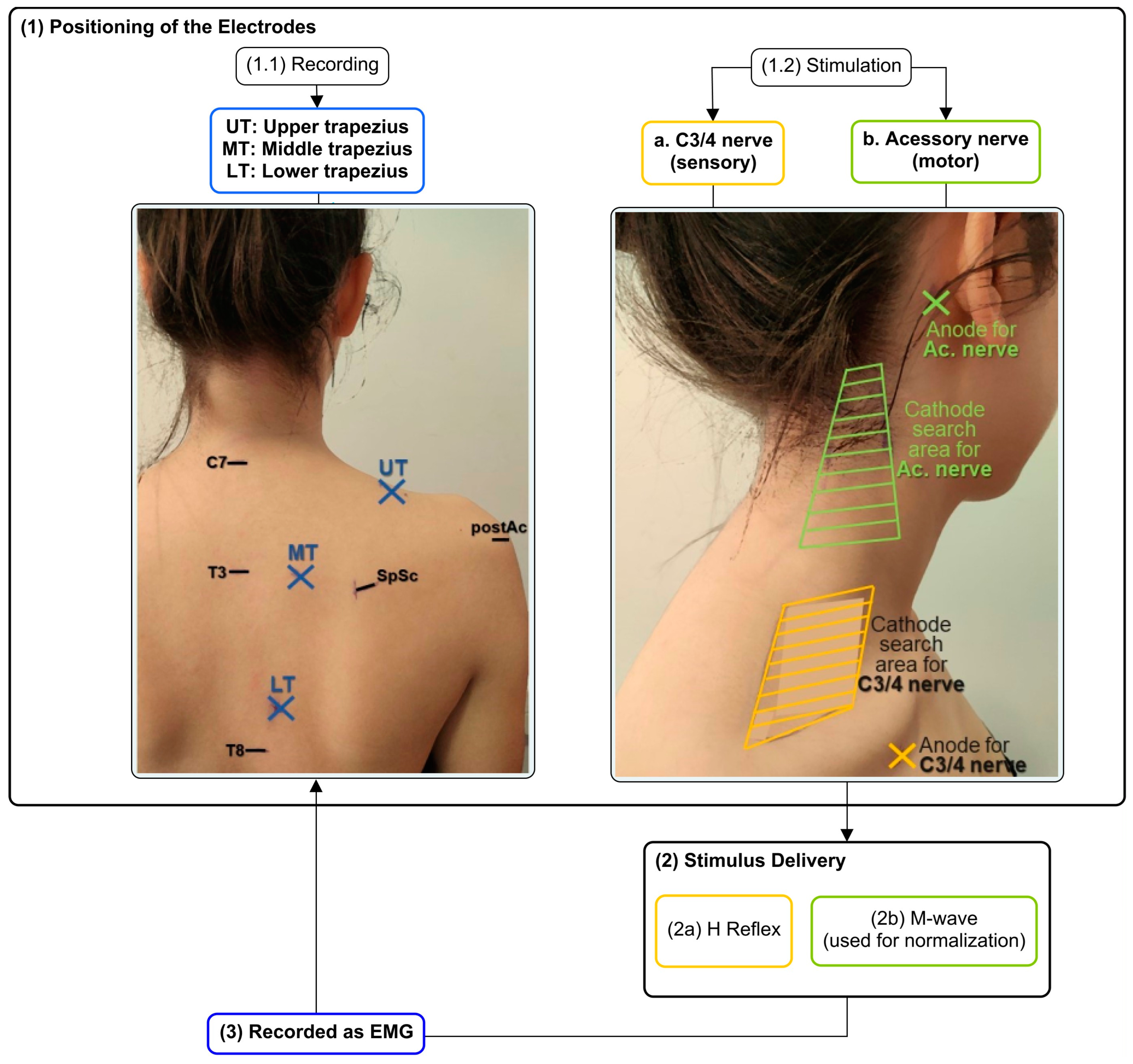 Sensors 23 04217 g001