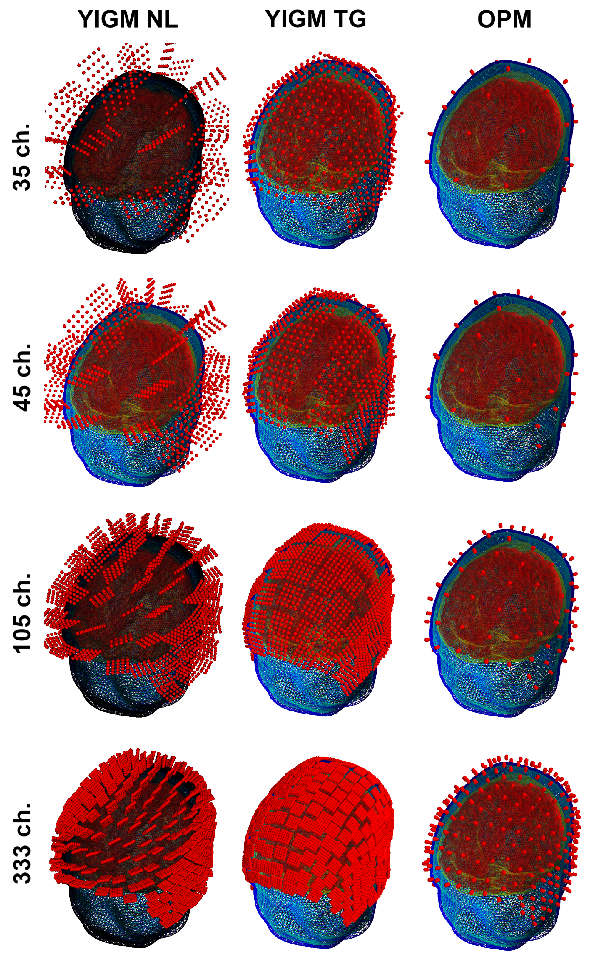 Sensors 23 04256 g005