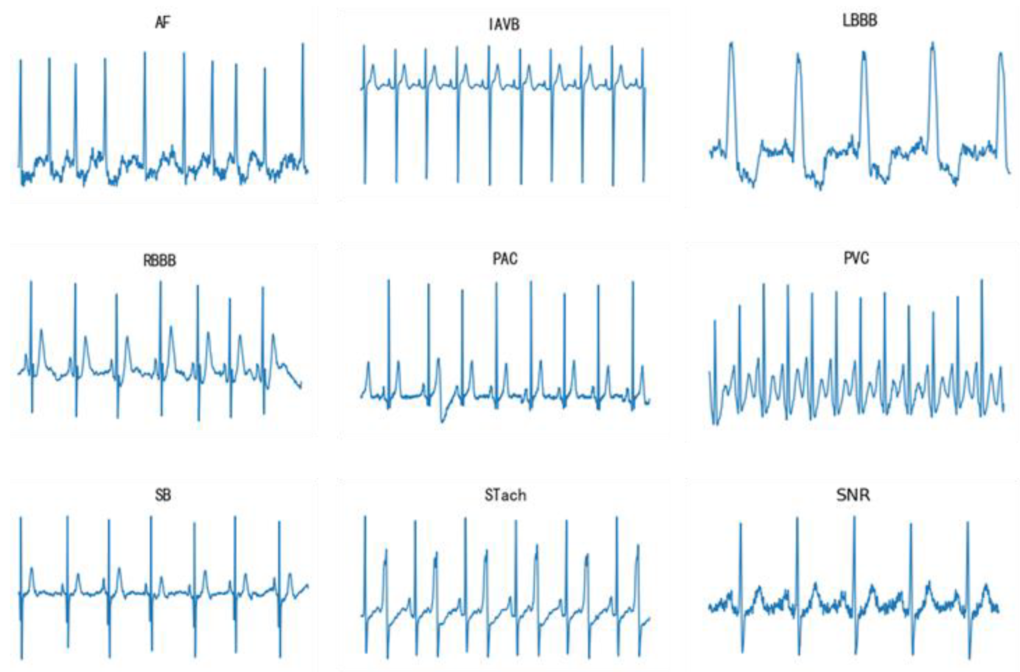 Sensors 23 04372 g001
