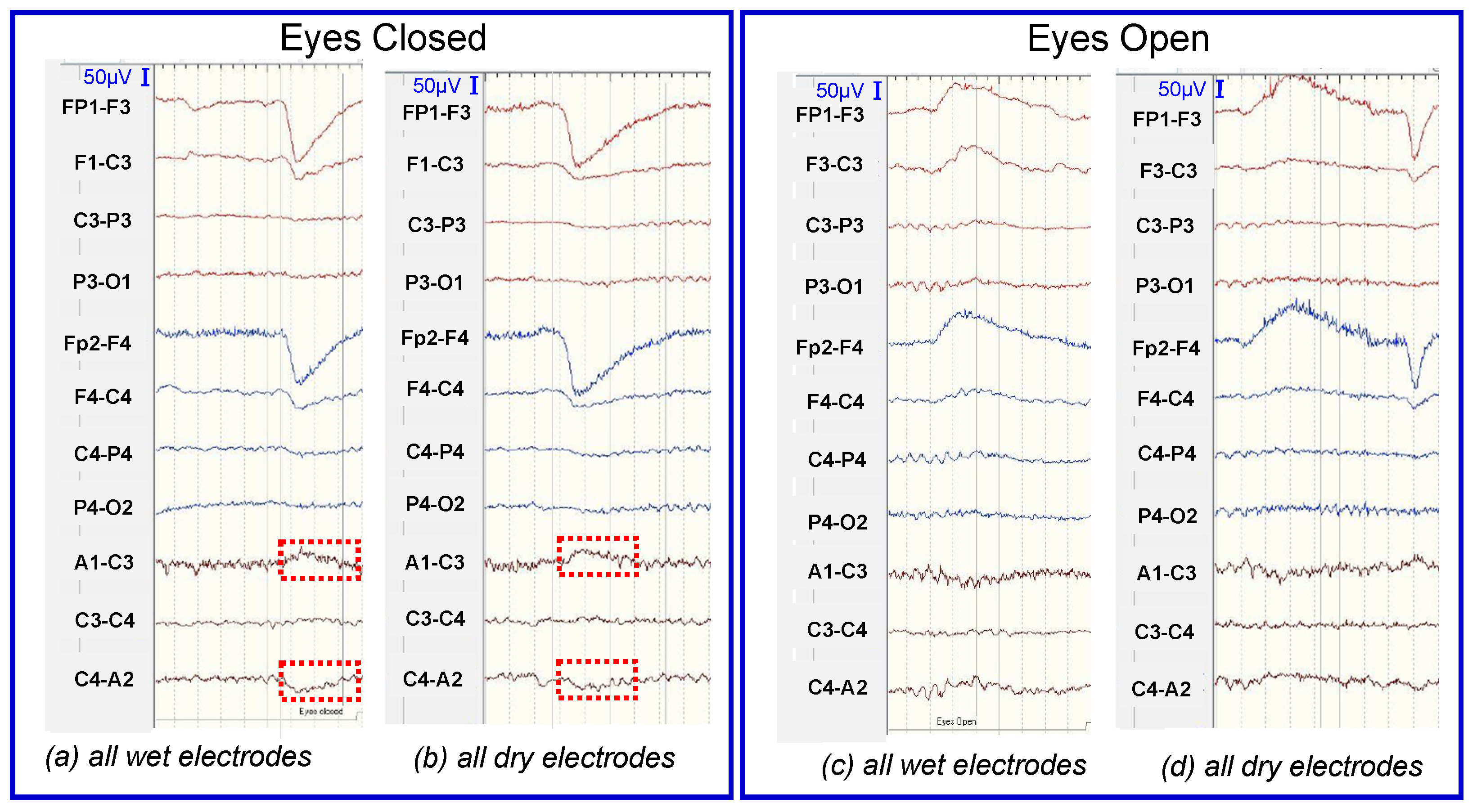 Sensors 23 04453 g008