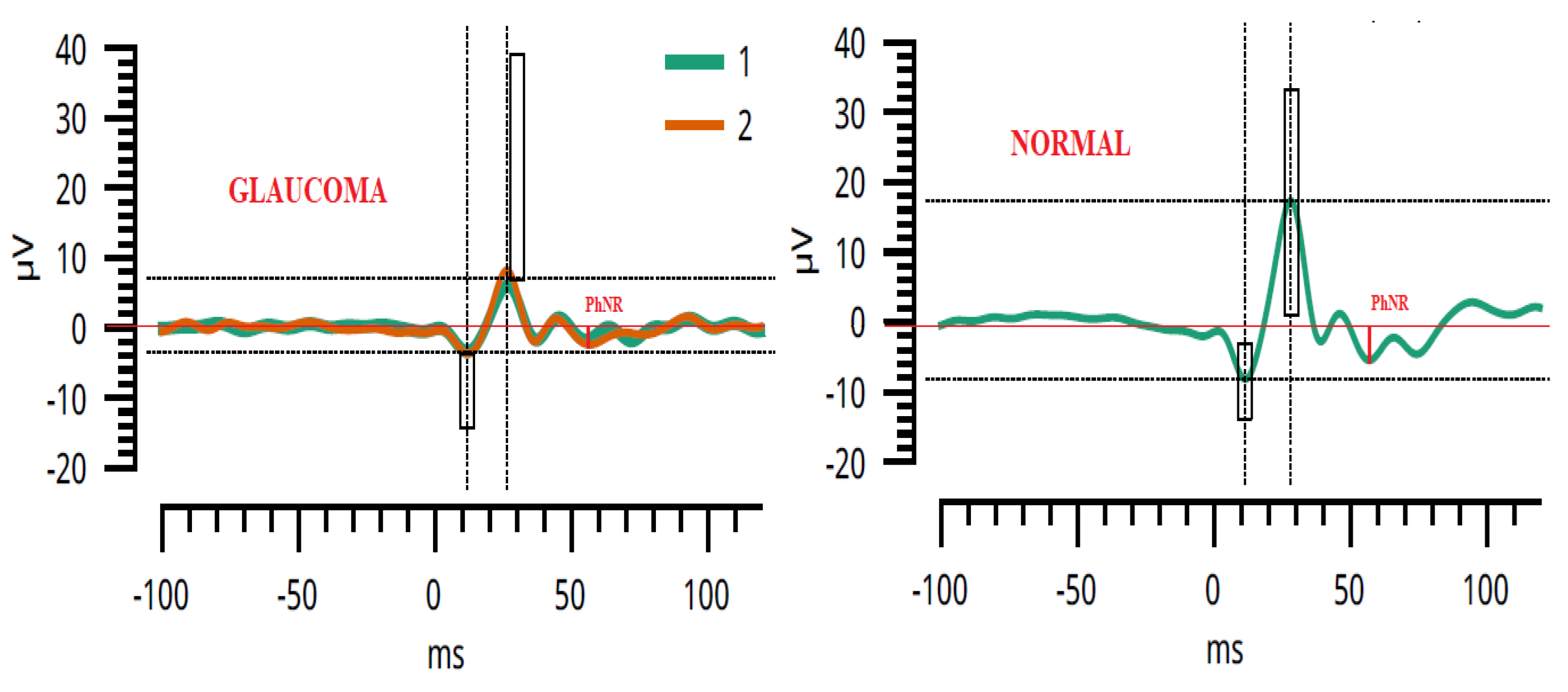 Sensors 23 04504 g002