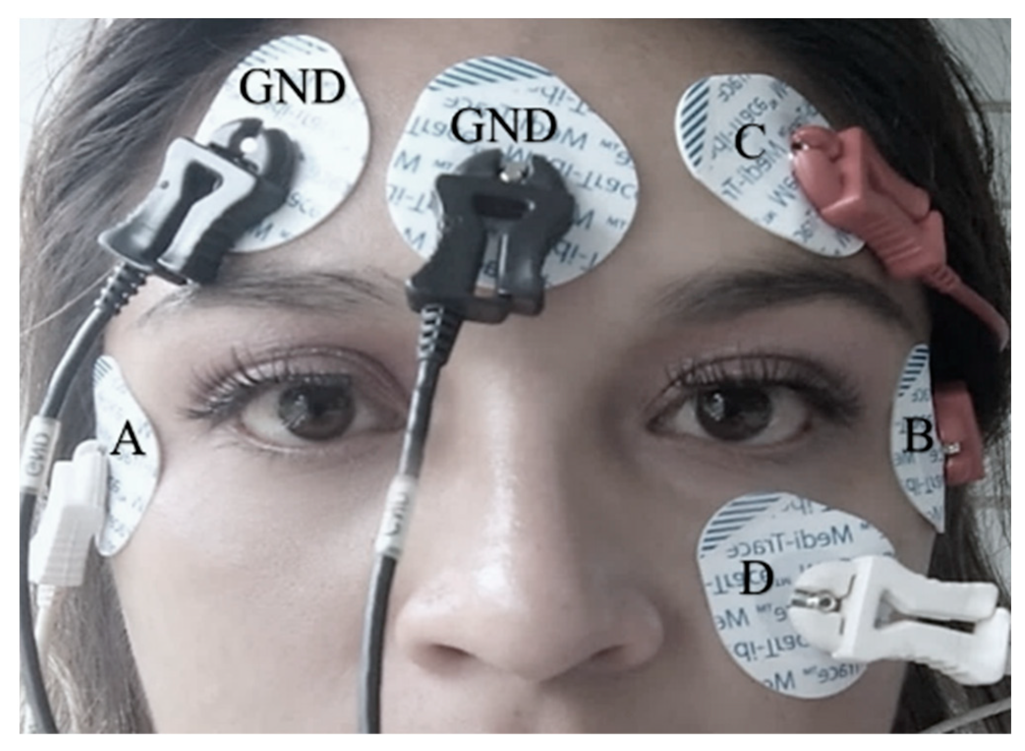 Sensors 23 04553 g001