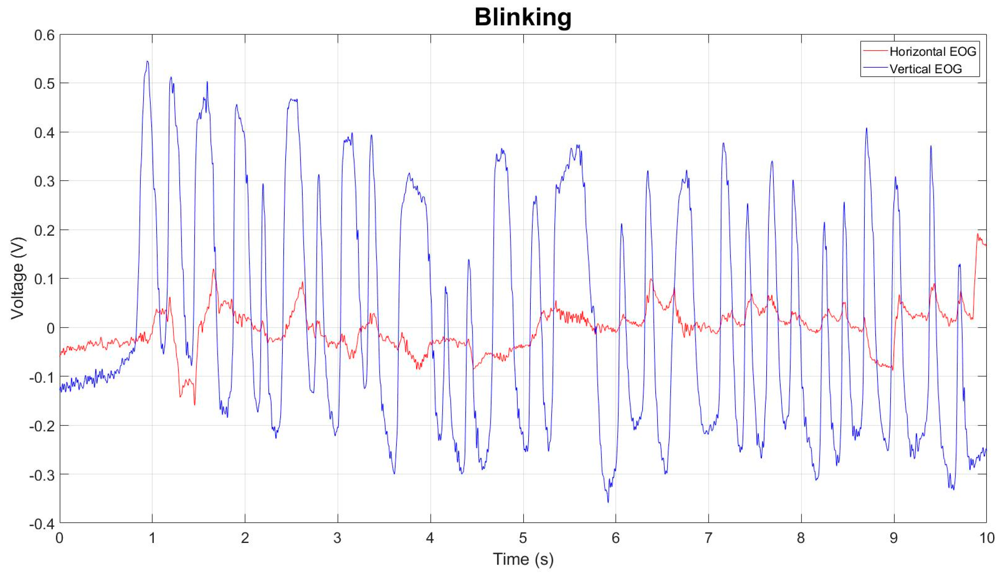 Sensors 23 04553 g004