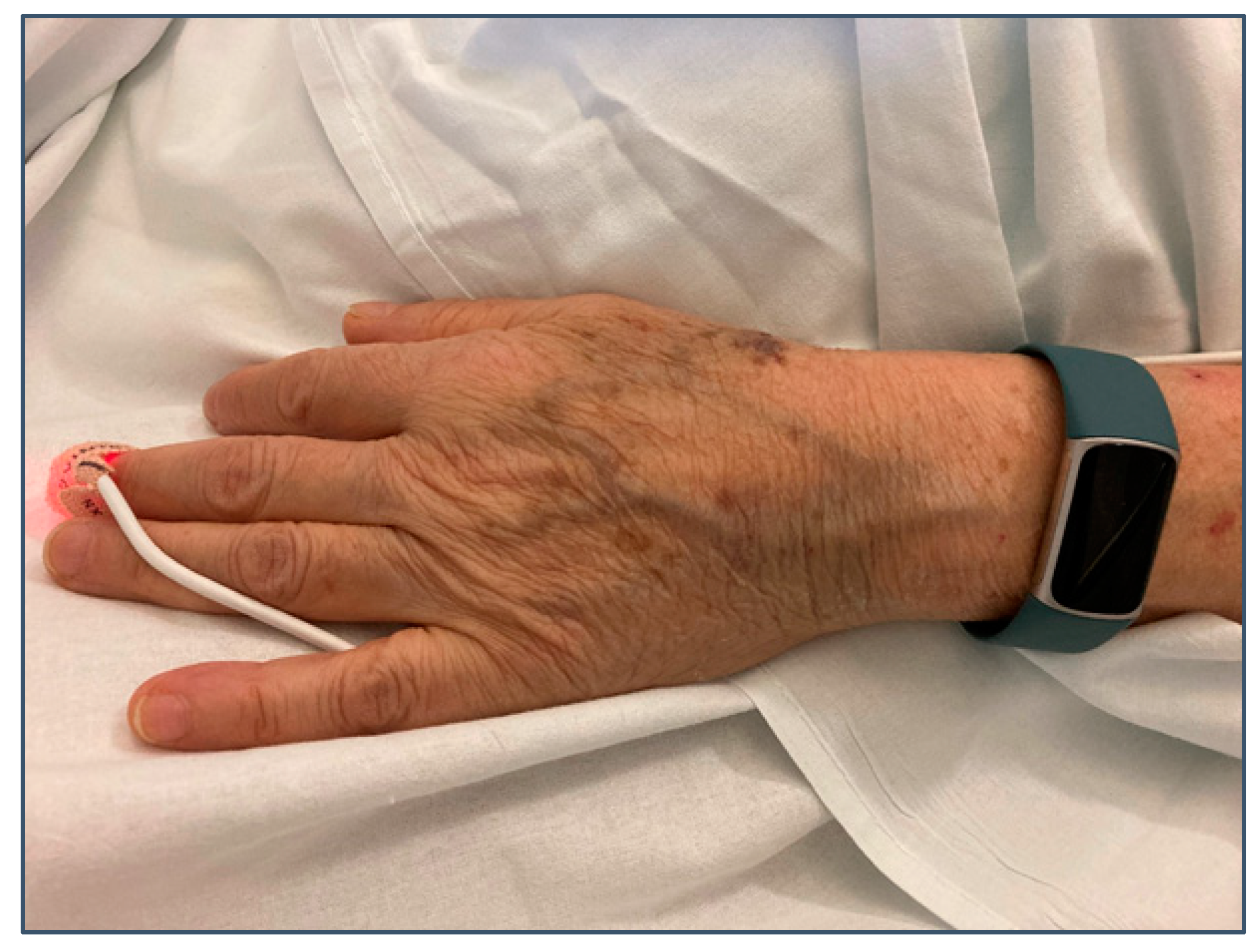 Sensors 23 04632 g004