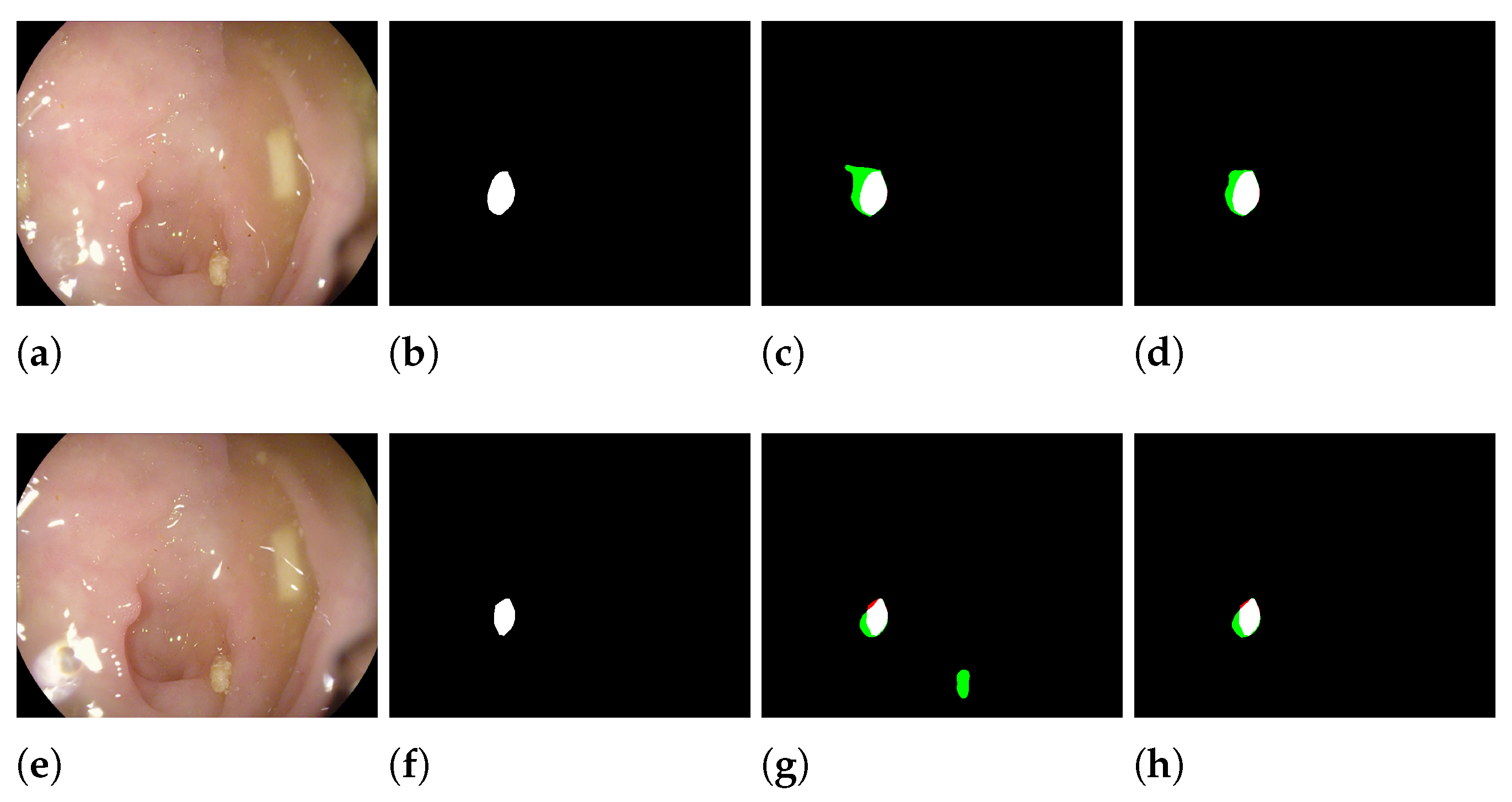 Sensors 23 04688 g005