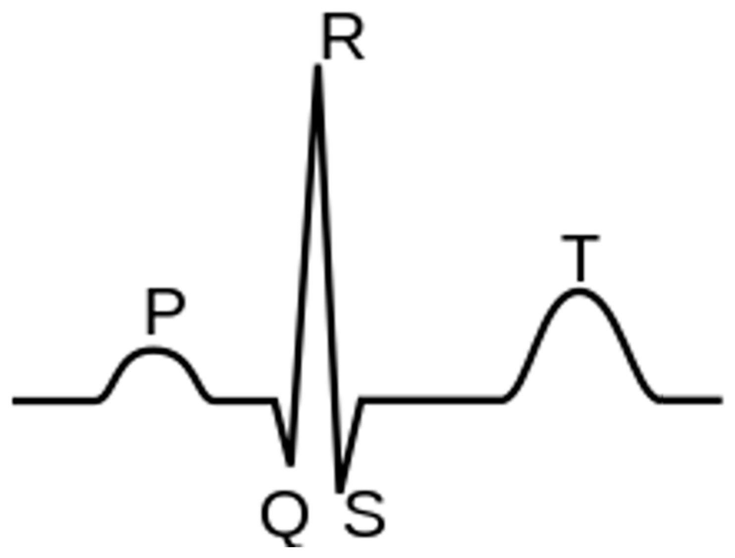 Sensors 23 04805 g003
