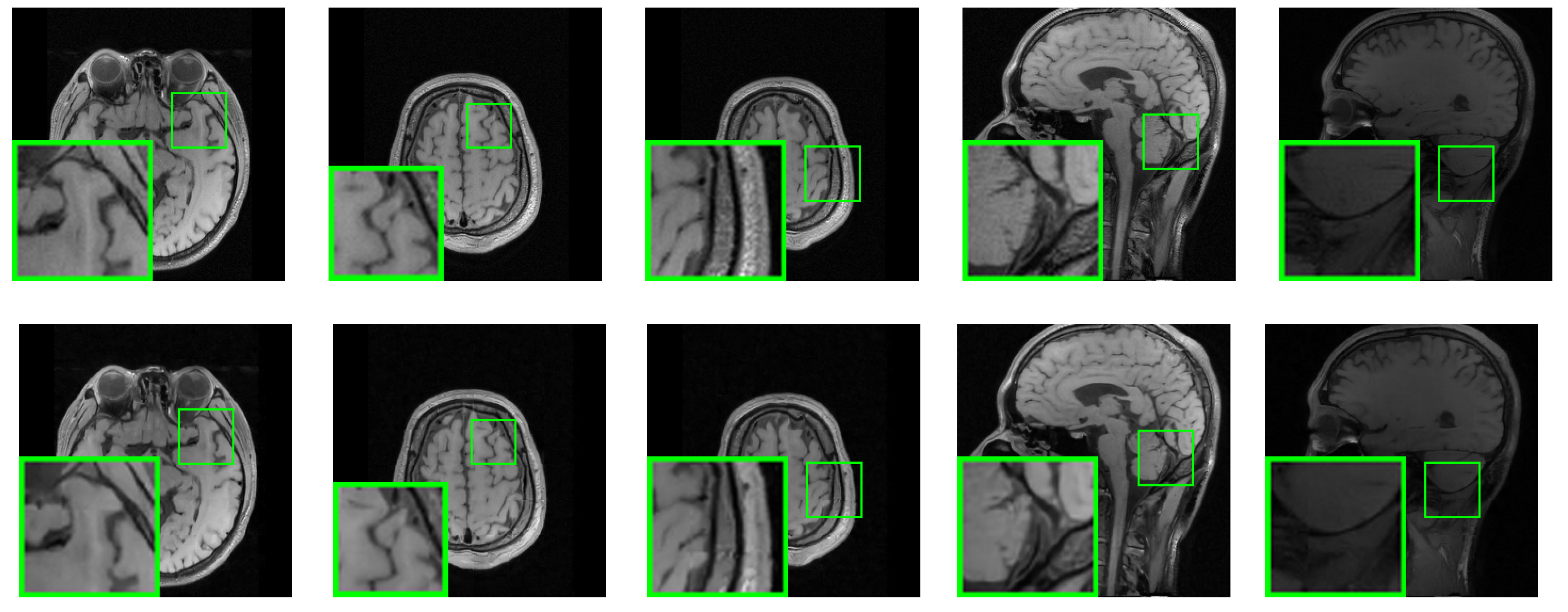 Sensors 23 05142 g010