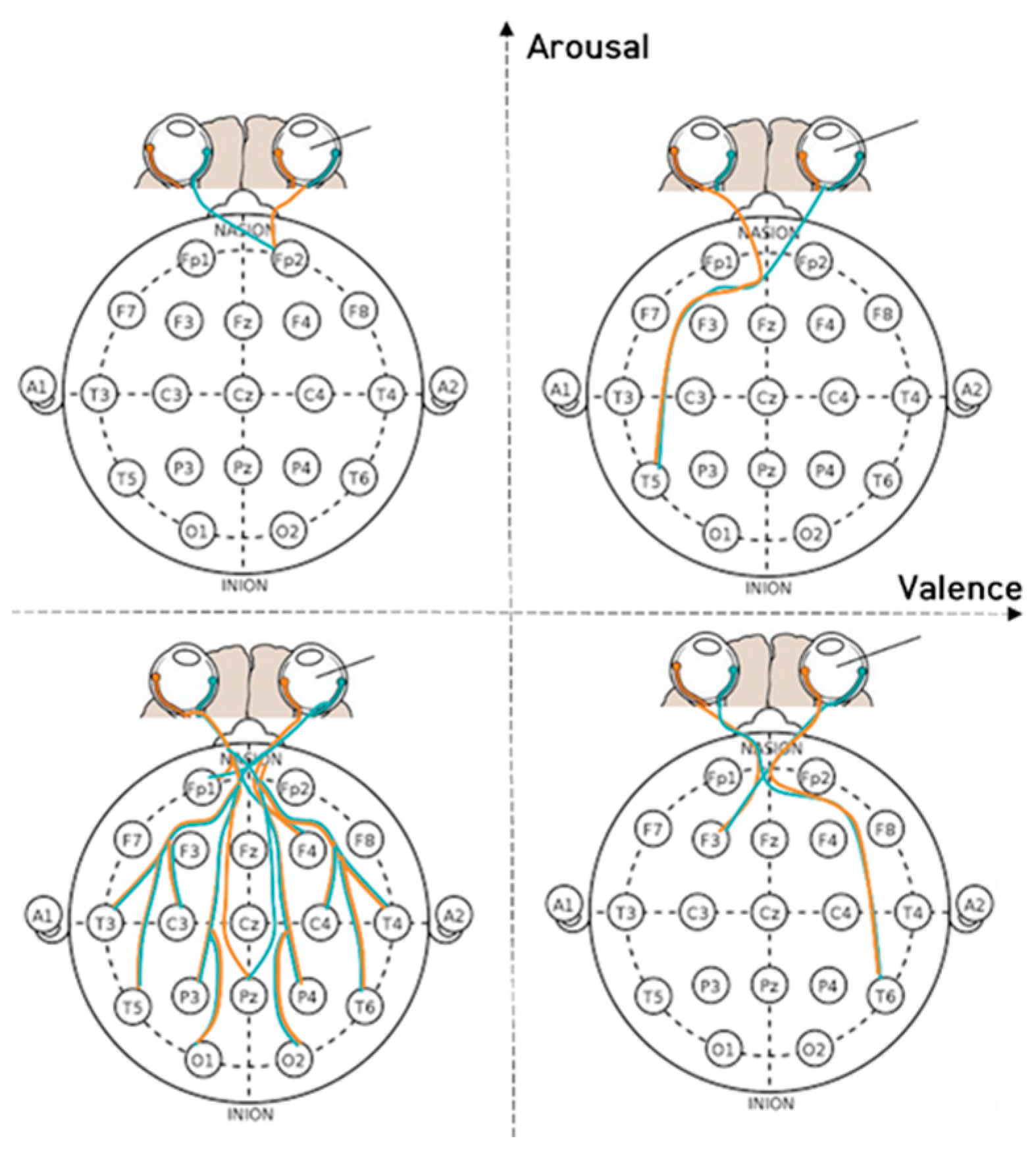 Sensors 23 05162 g010