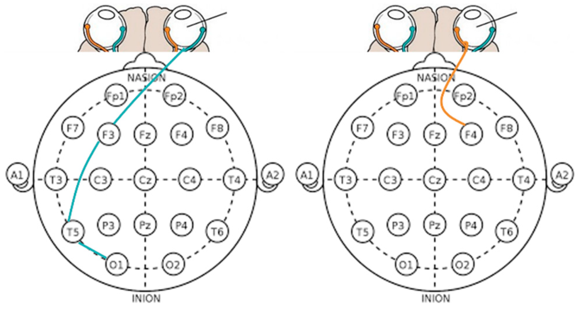 Sensors 23 05162 g018