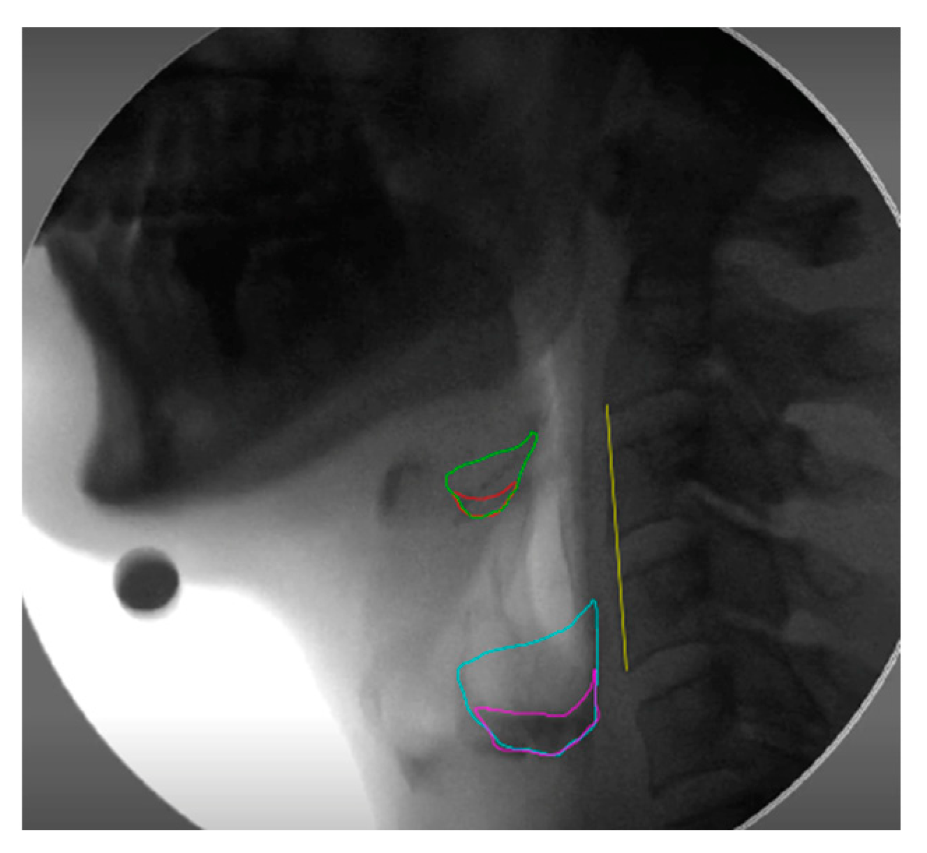 Sensors 23 05392 g004 Sensors 23 05392 g004