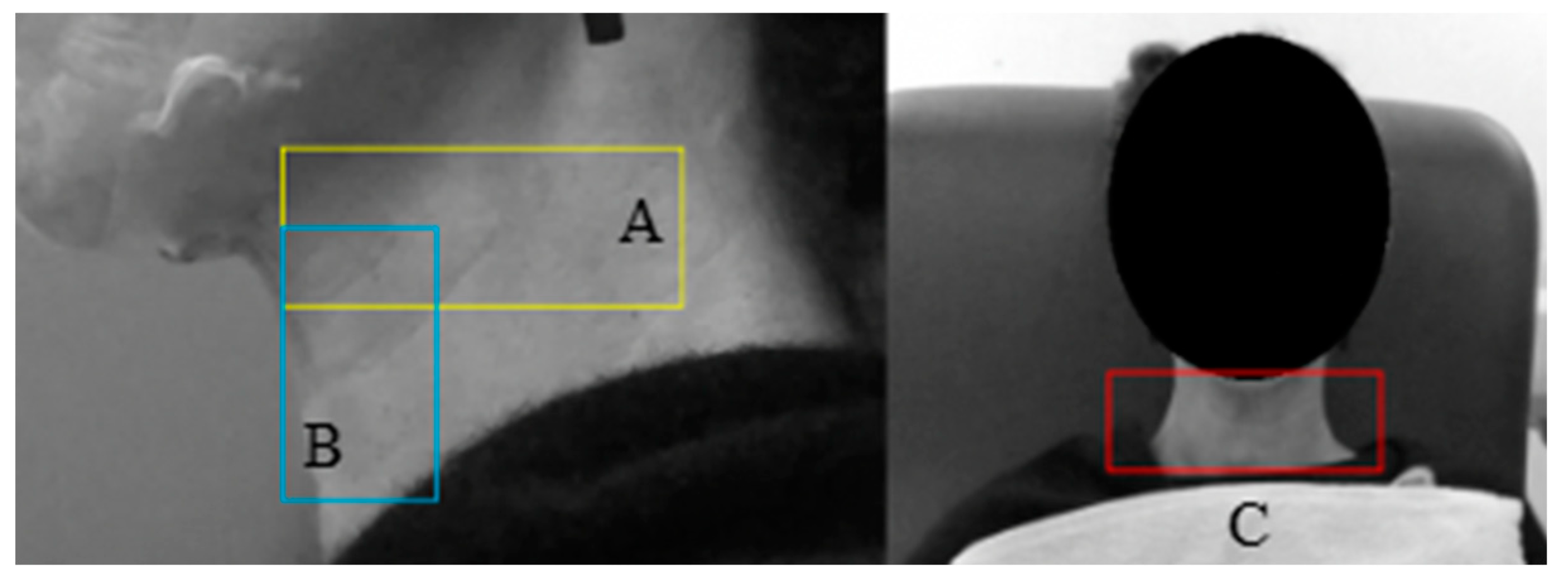Sensors 23 05392 g005 Sensors 23 05392 g005
