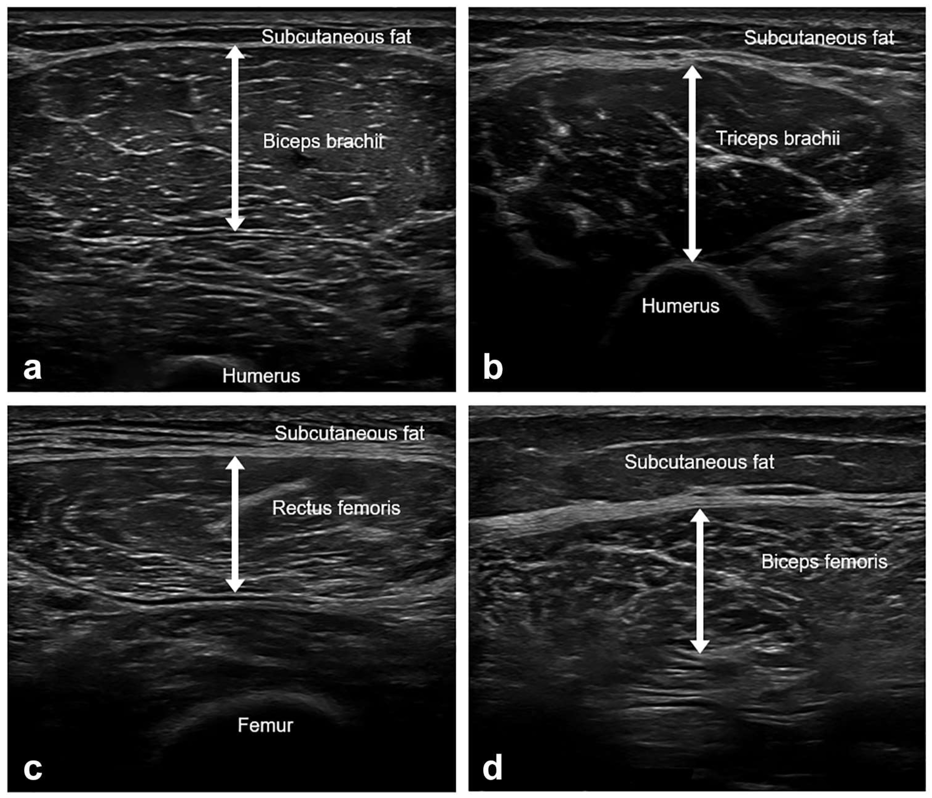 Sensors 23 05490 g001