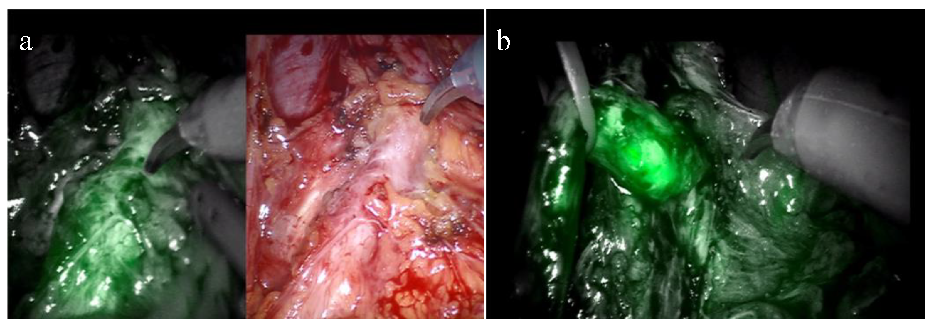 Sensors 23 05497 g002 Sensors 23 05497 g002