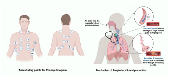 Sensors 23 05514 g001