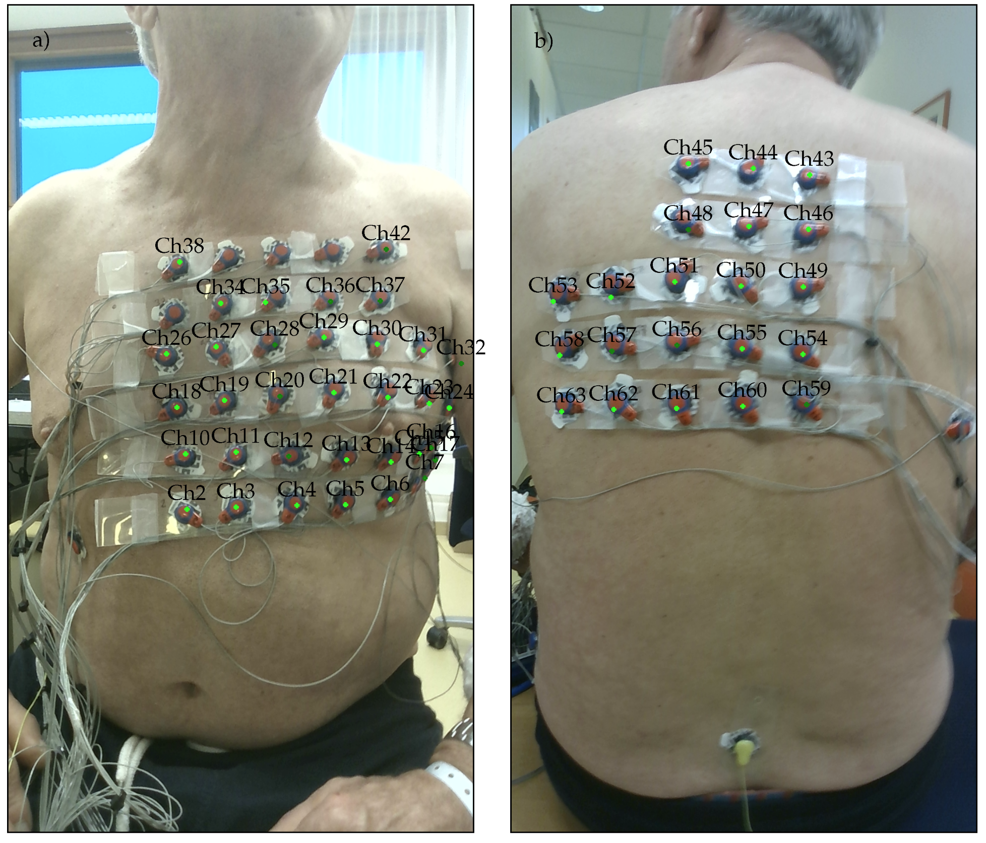 Sensors 23 05552 g003