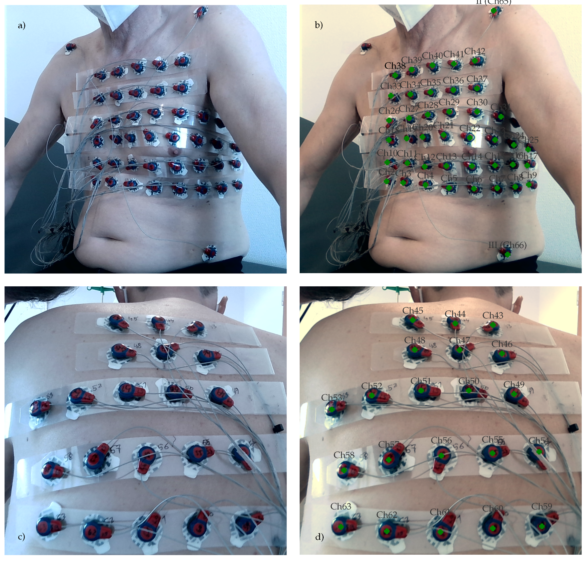 Sensors 23 05552 g004