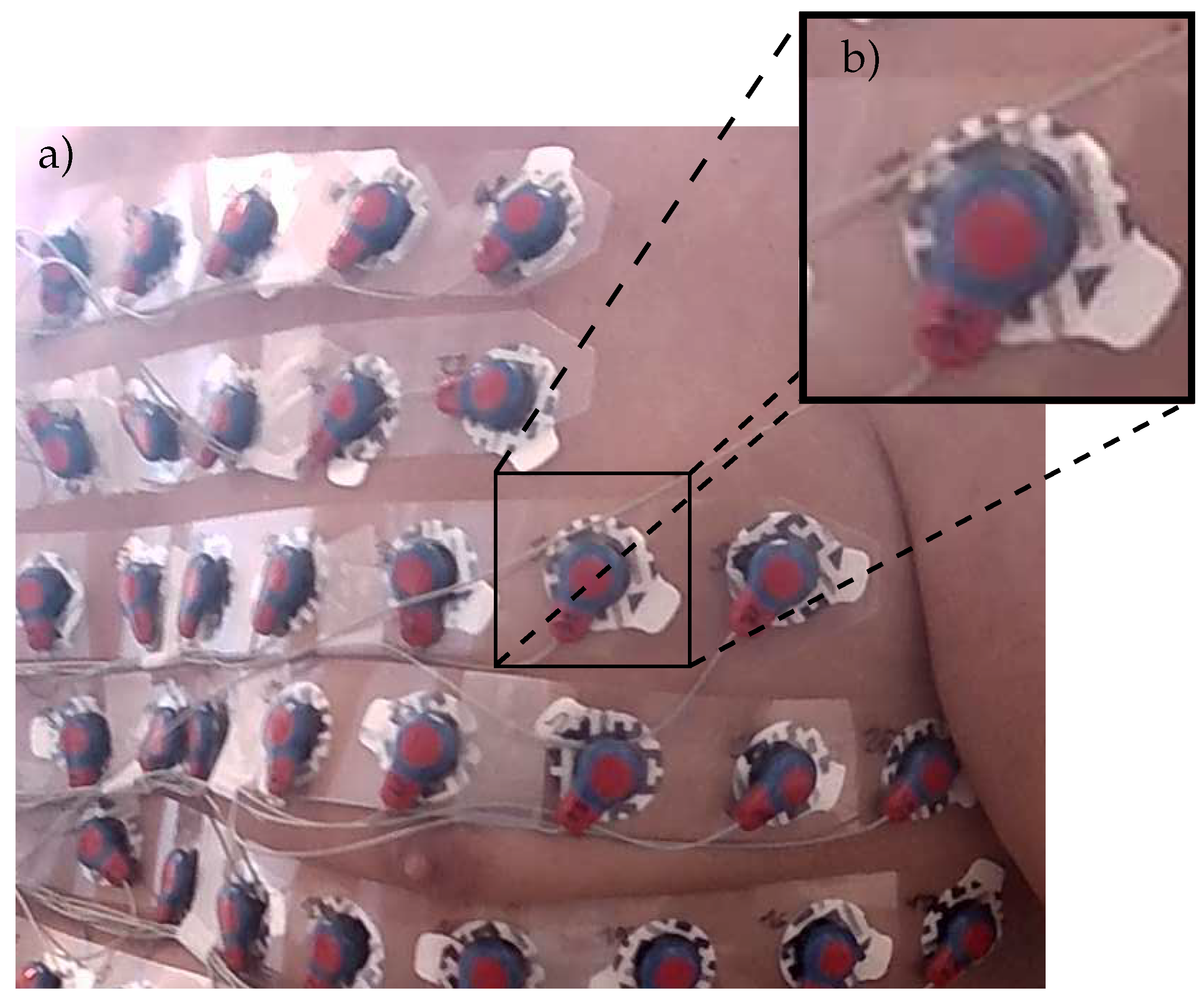 Sensors 23 05552 g005