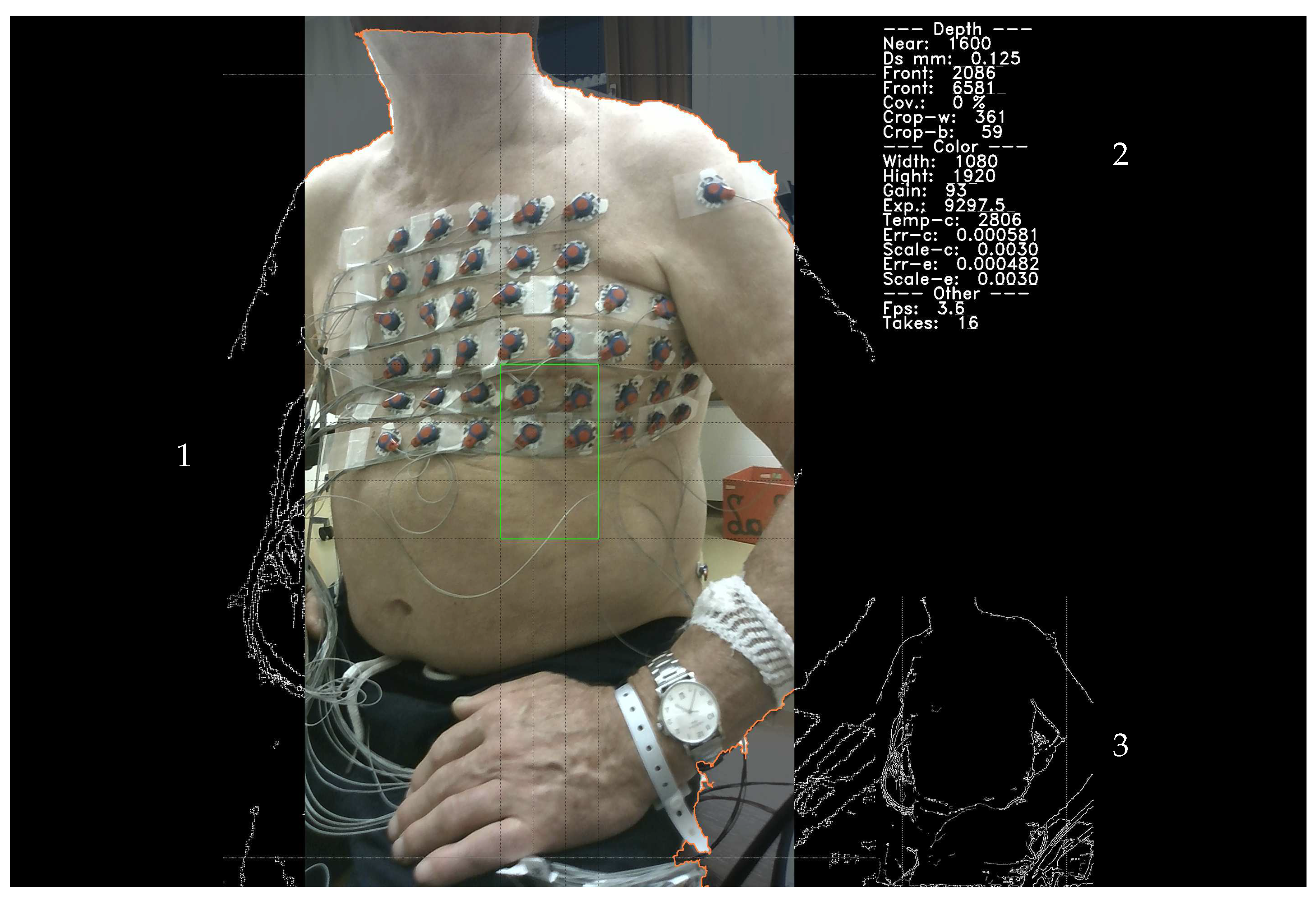 Sensors 23 05552 g007