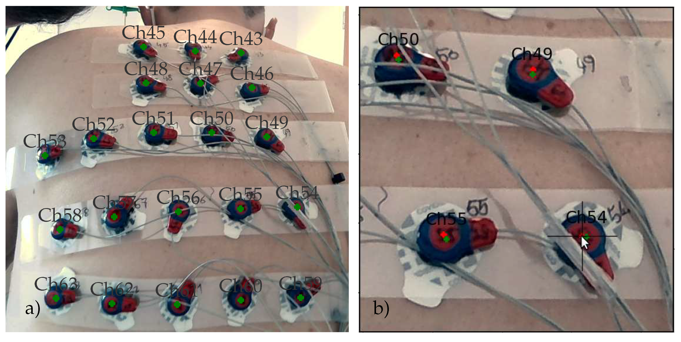 Sensors 23 05552 g008