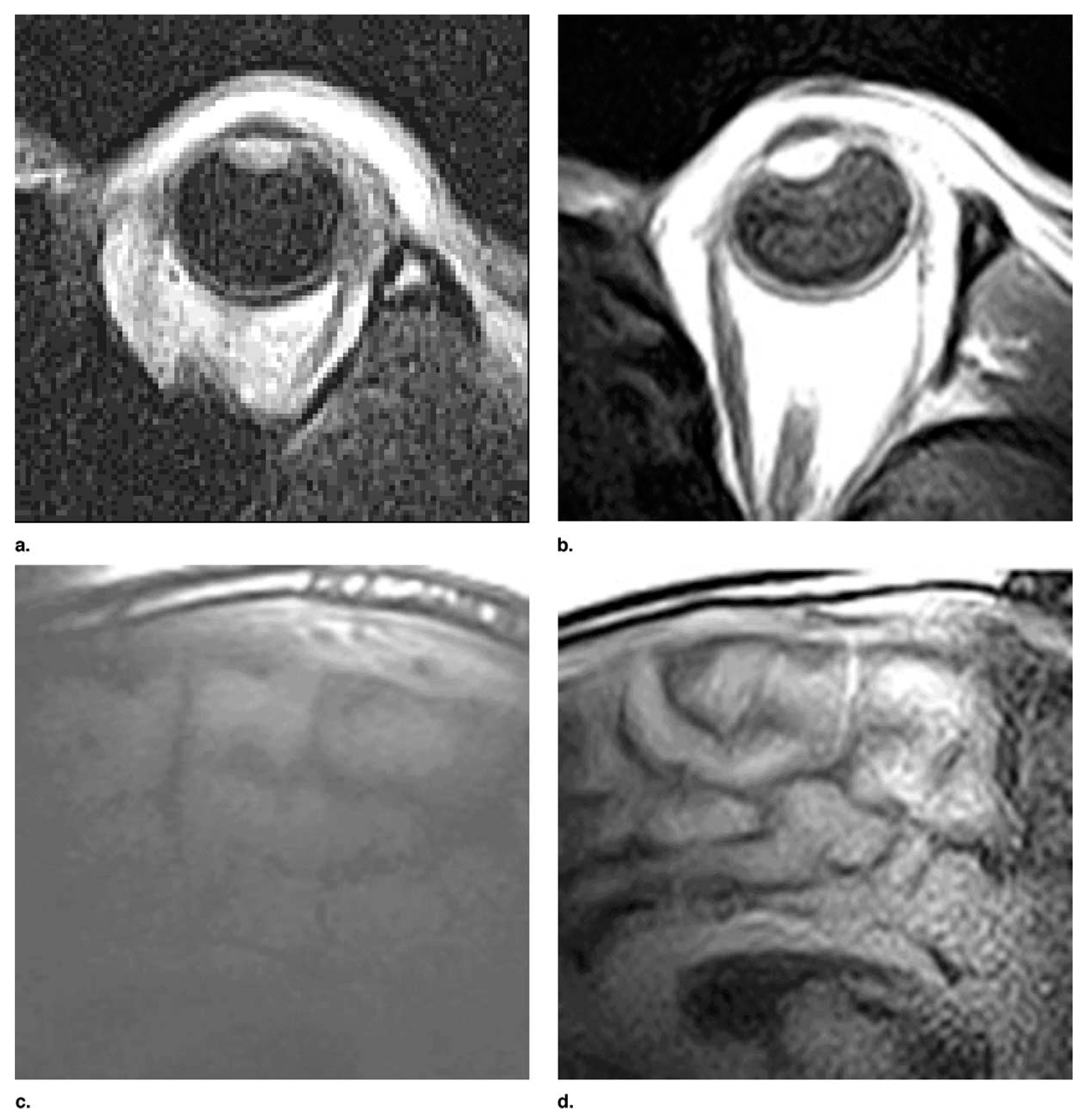 Sensors 23 05586 g010