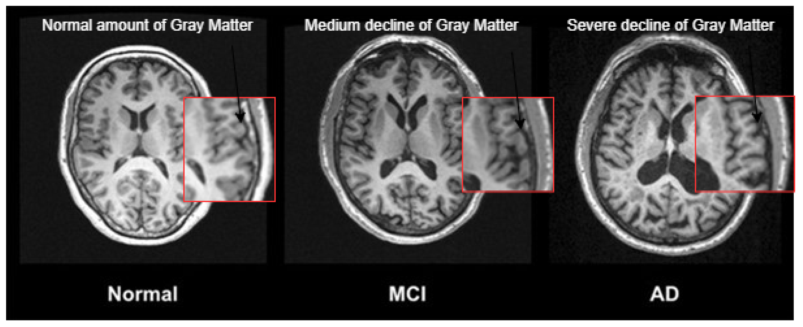 Sensors 23 05648 g001 Sensors 23 05648 g001