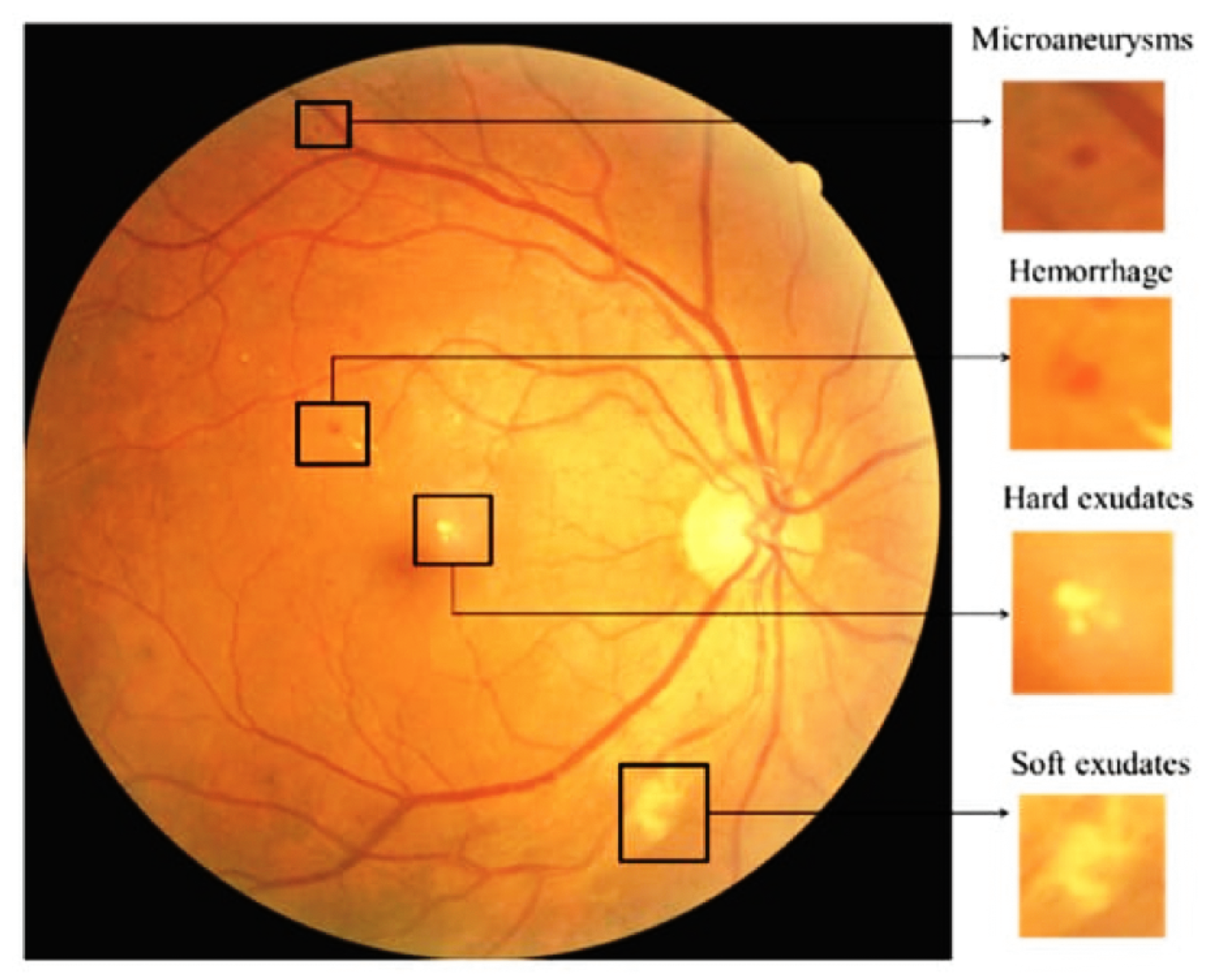 Sensors 23 05726 g001